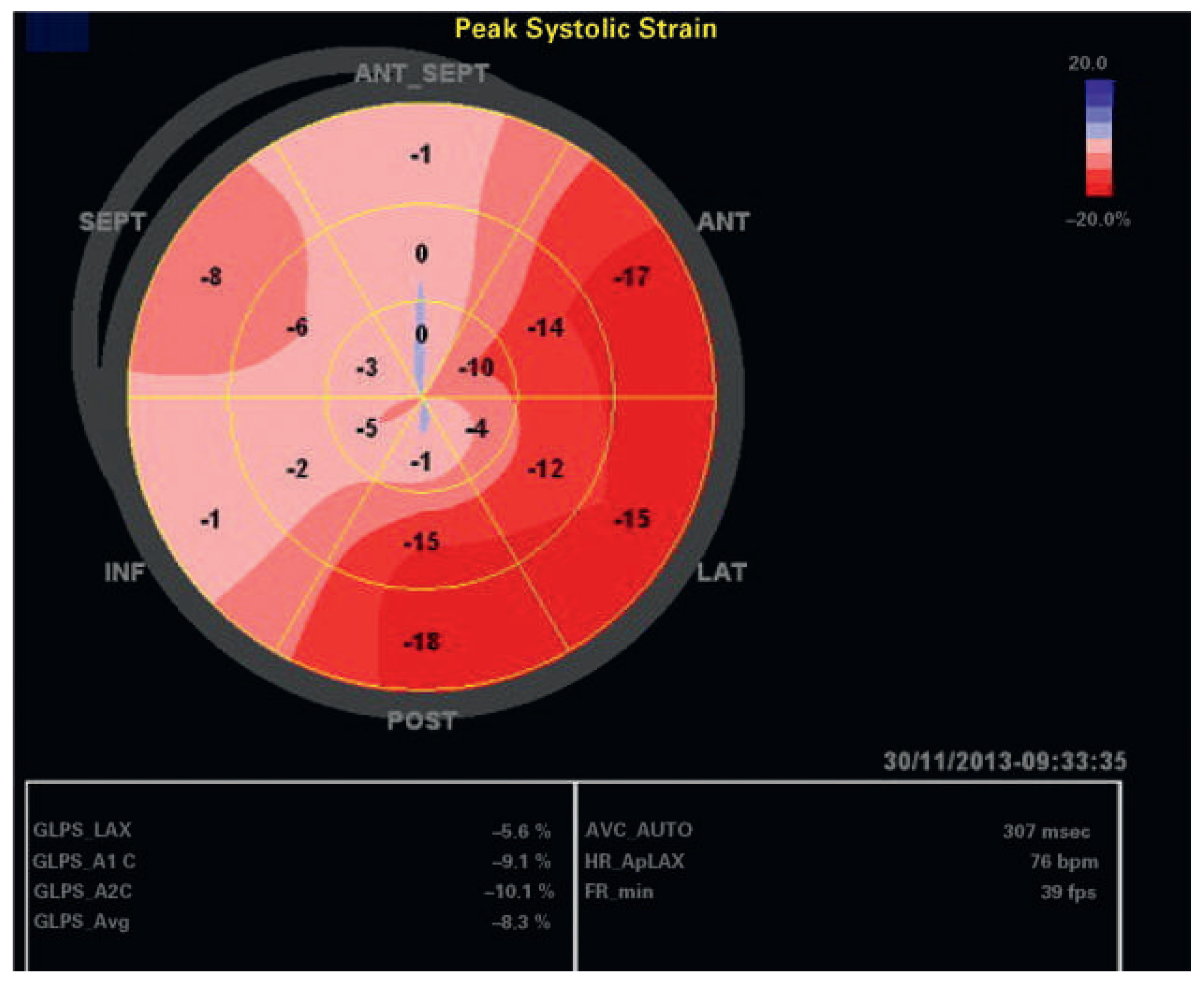 Cardiovascmed 19 00204 g004