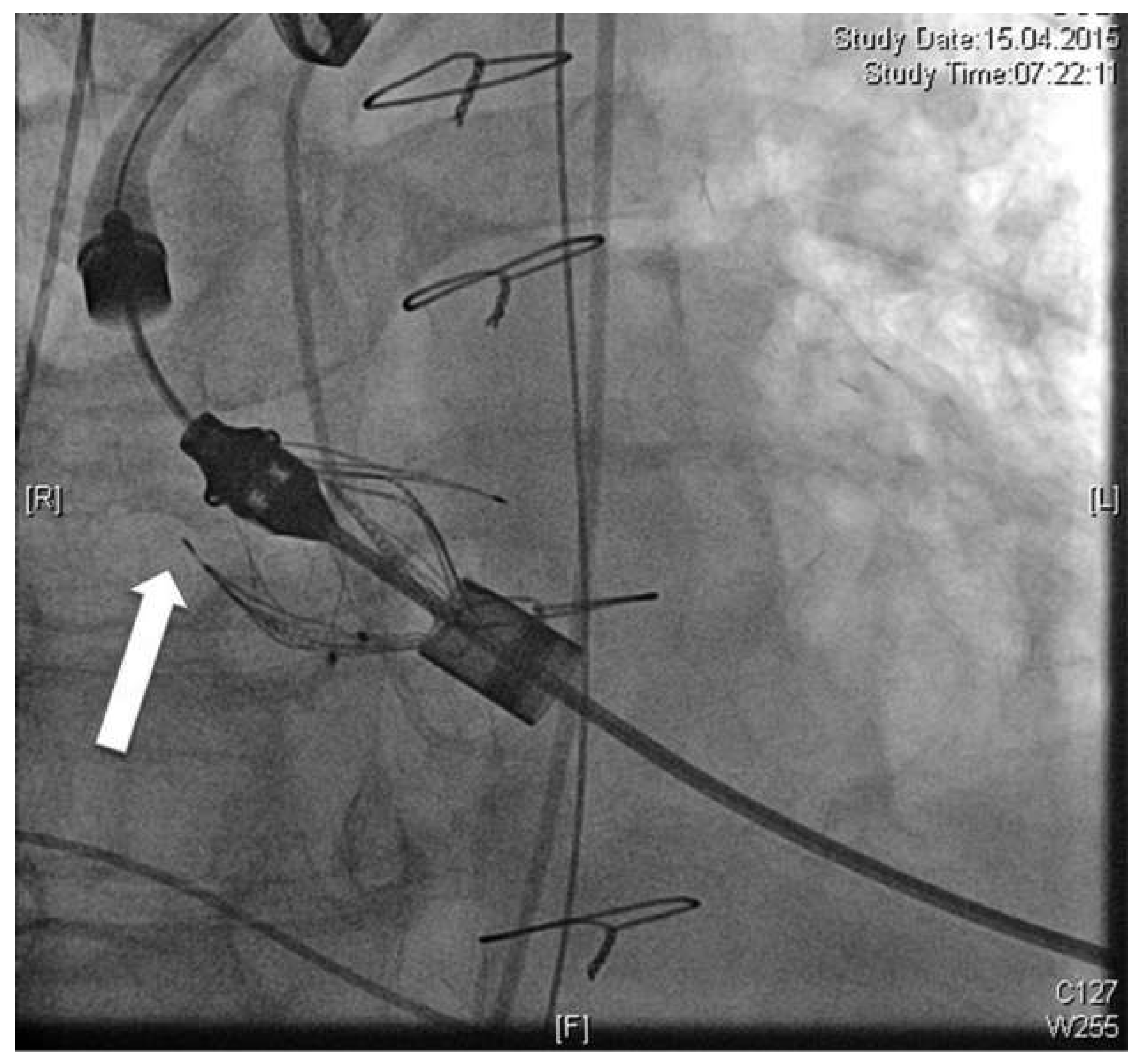 Cardiovascmed 19 00220 g001