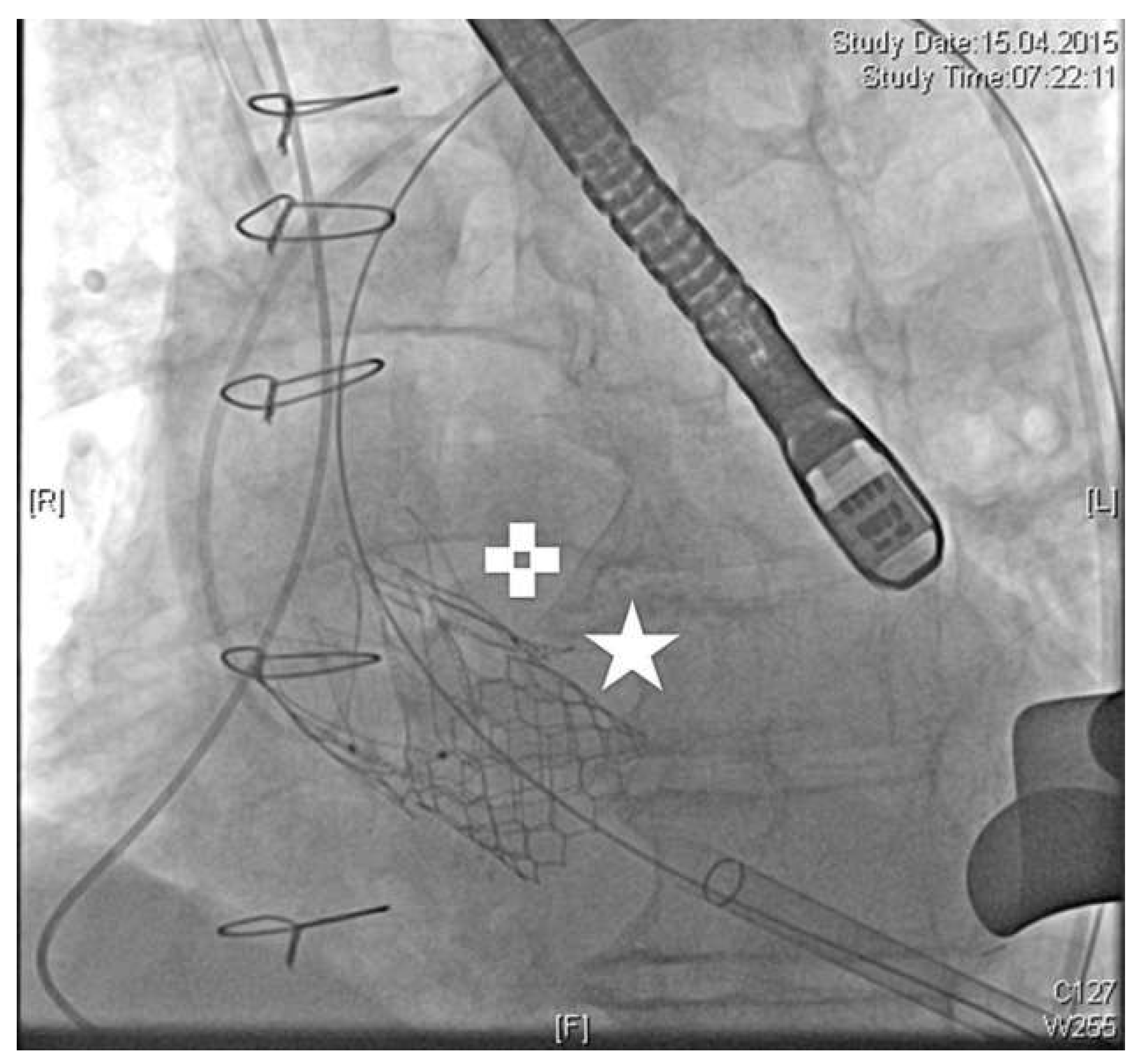 Cardiovascmed 19 00220 g002