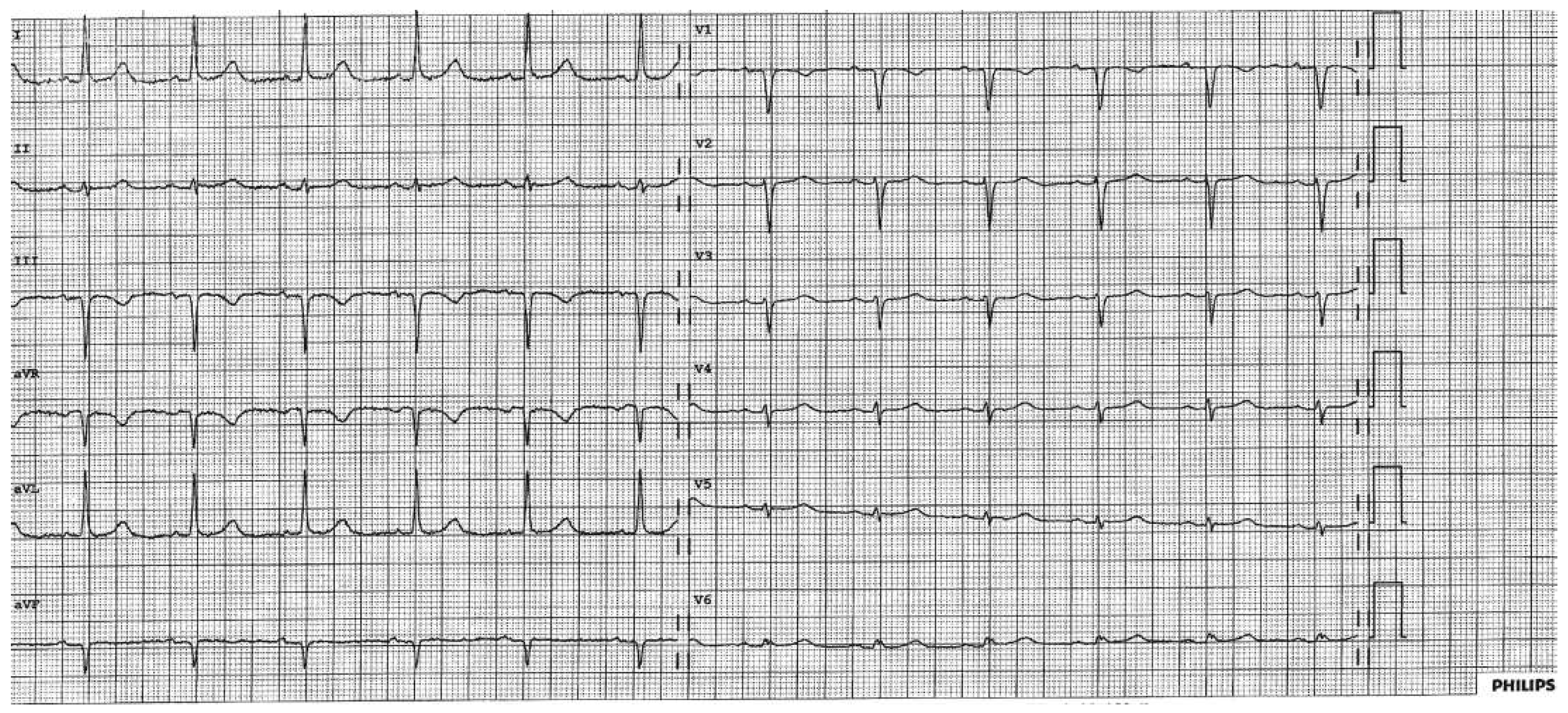Cardiovascmed 19 00239 g001