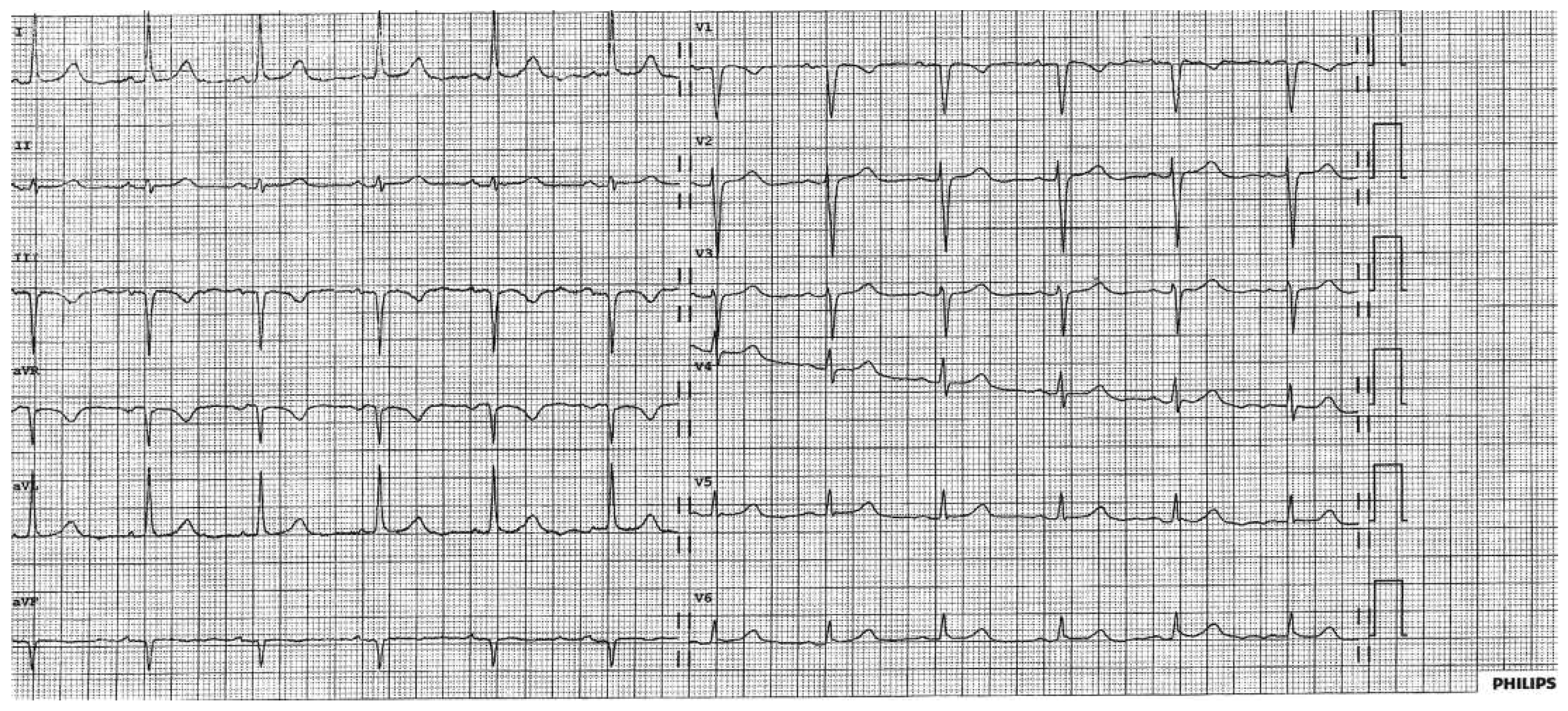 Cardiovascmed 19 00239 g002