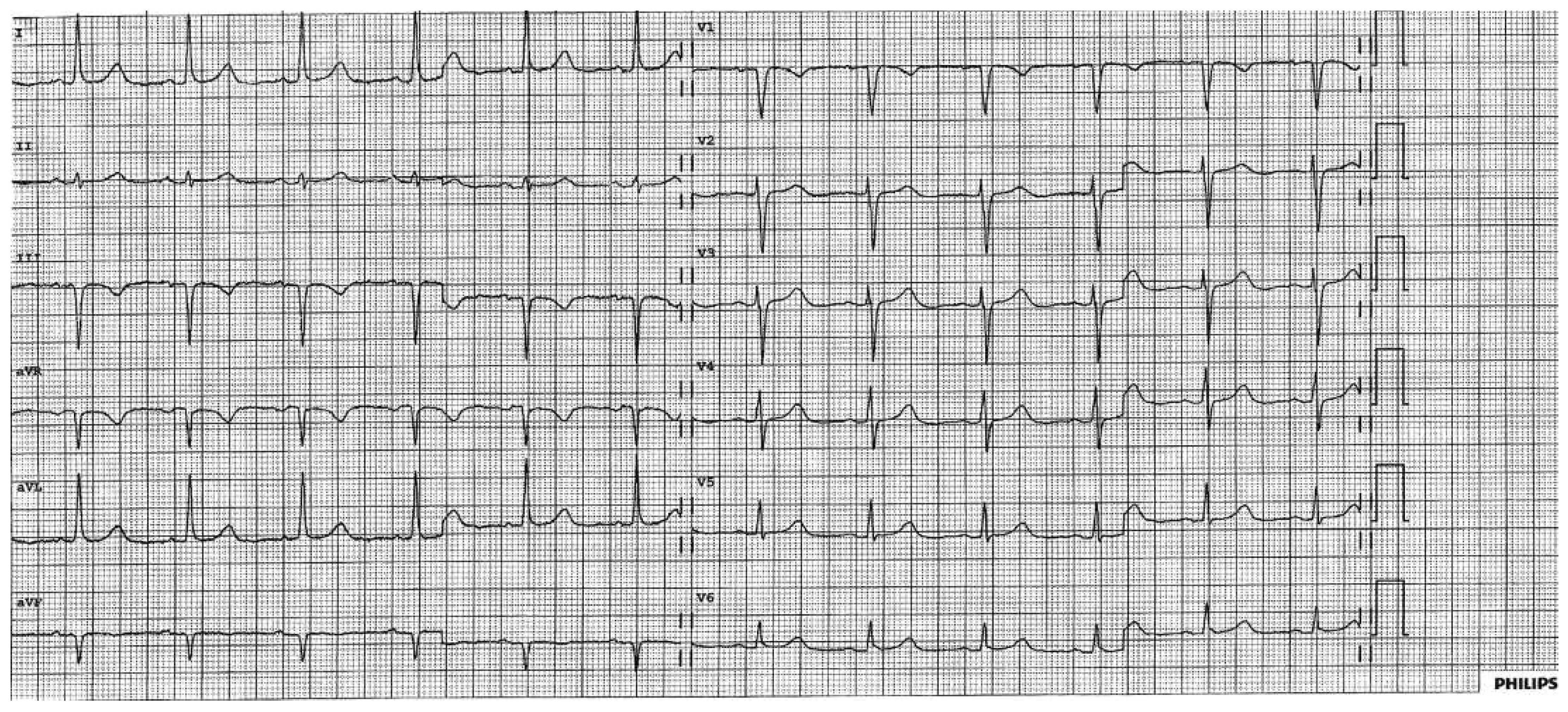 Cardiovascmed 19 00239 g003