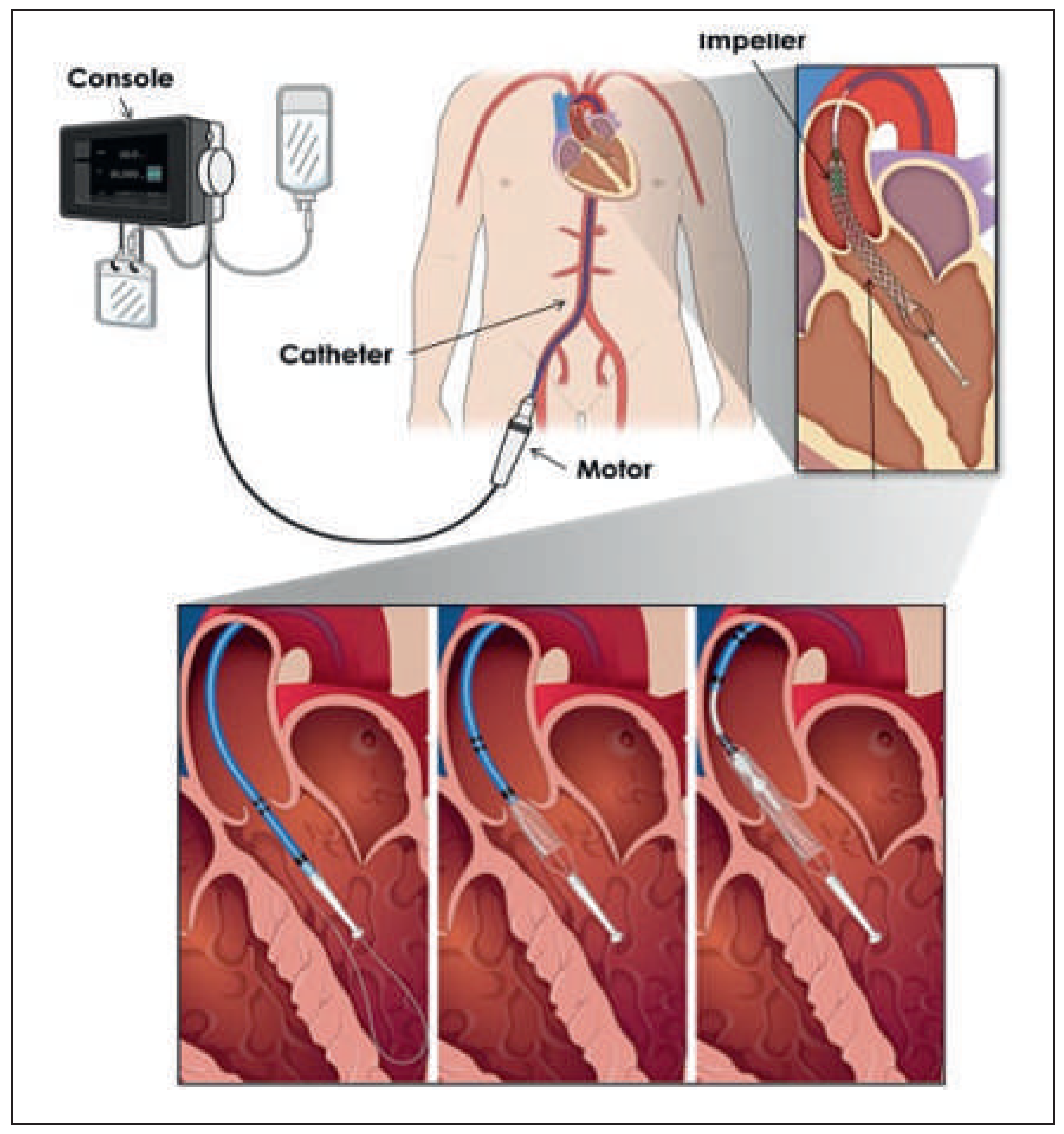 Cardiovascmed 19 00241 g001