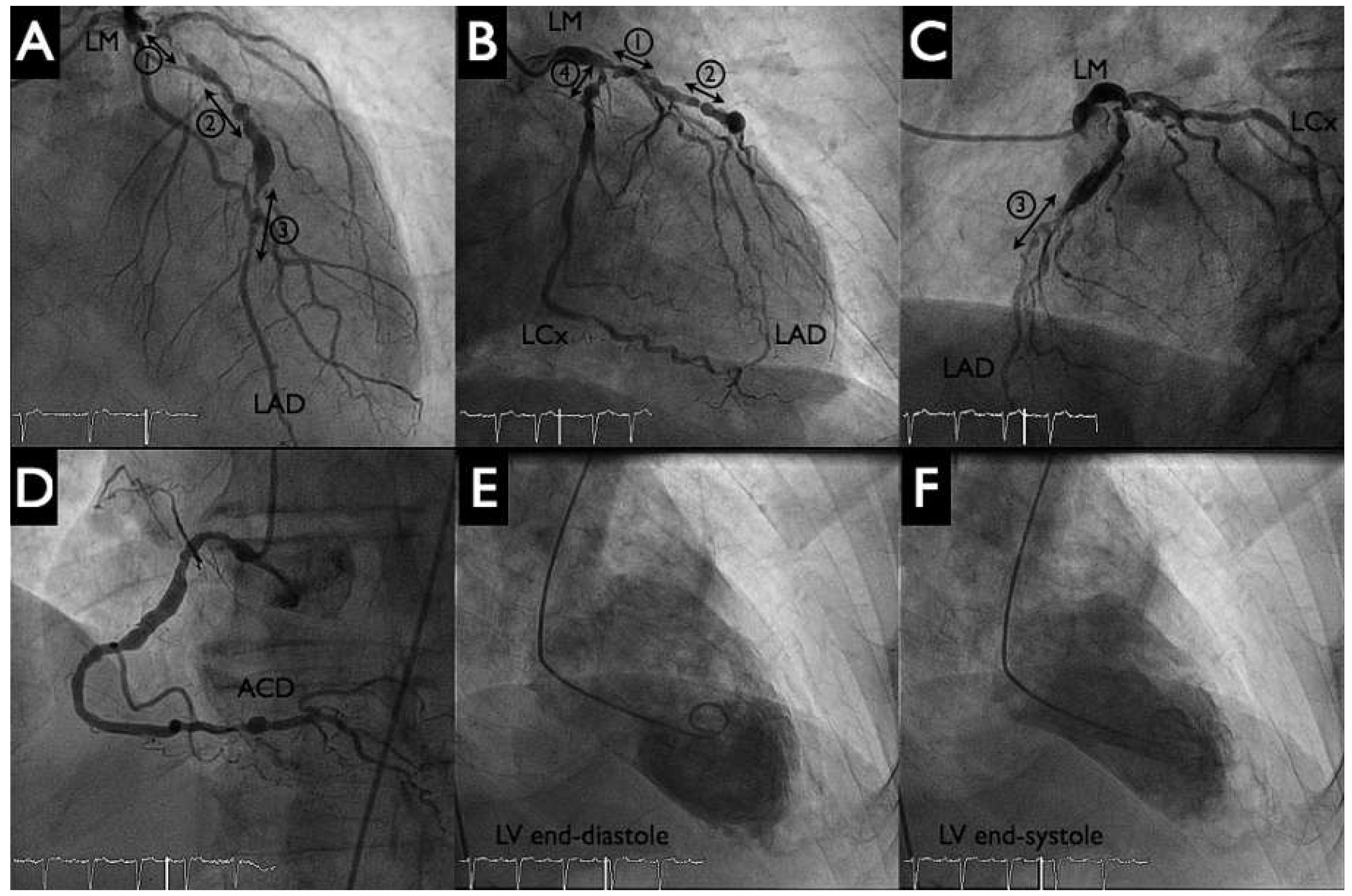 Cardiovascmed 19 00241 g002