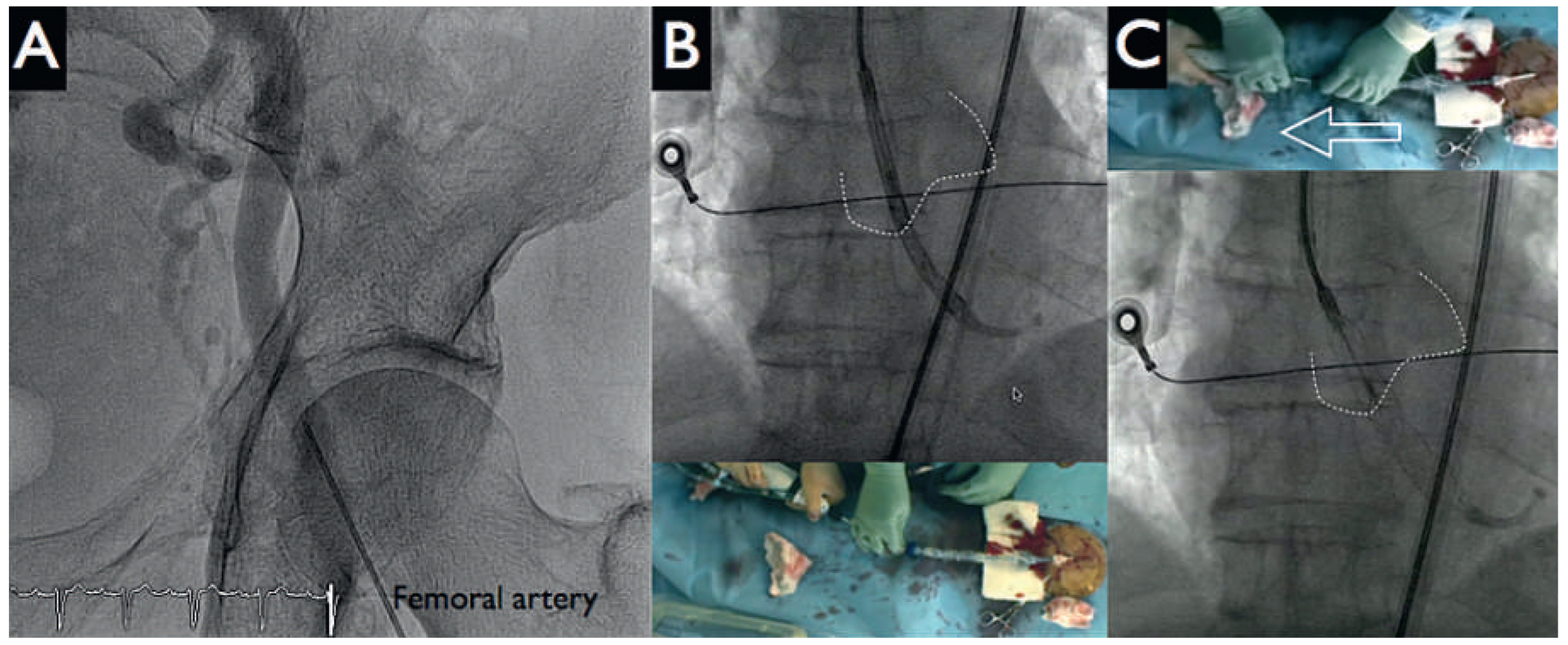 Cardiovascmed 19 00241 g003