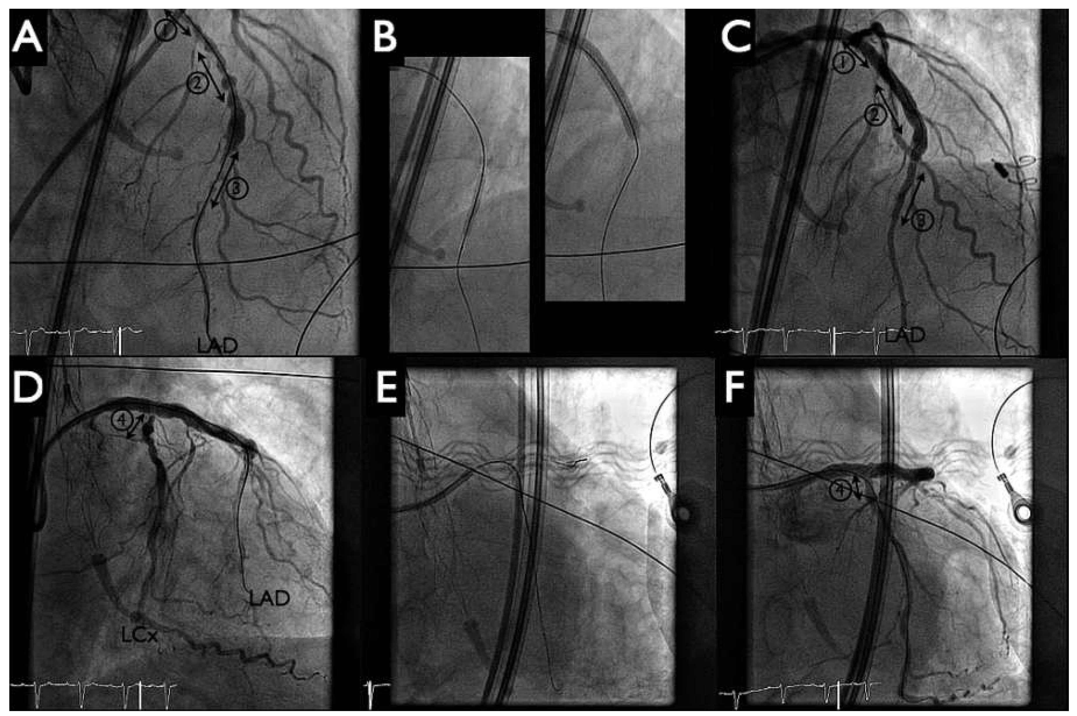 Cardiovascmed 19 00241 g004