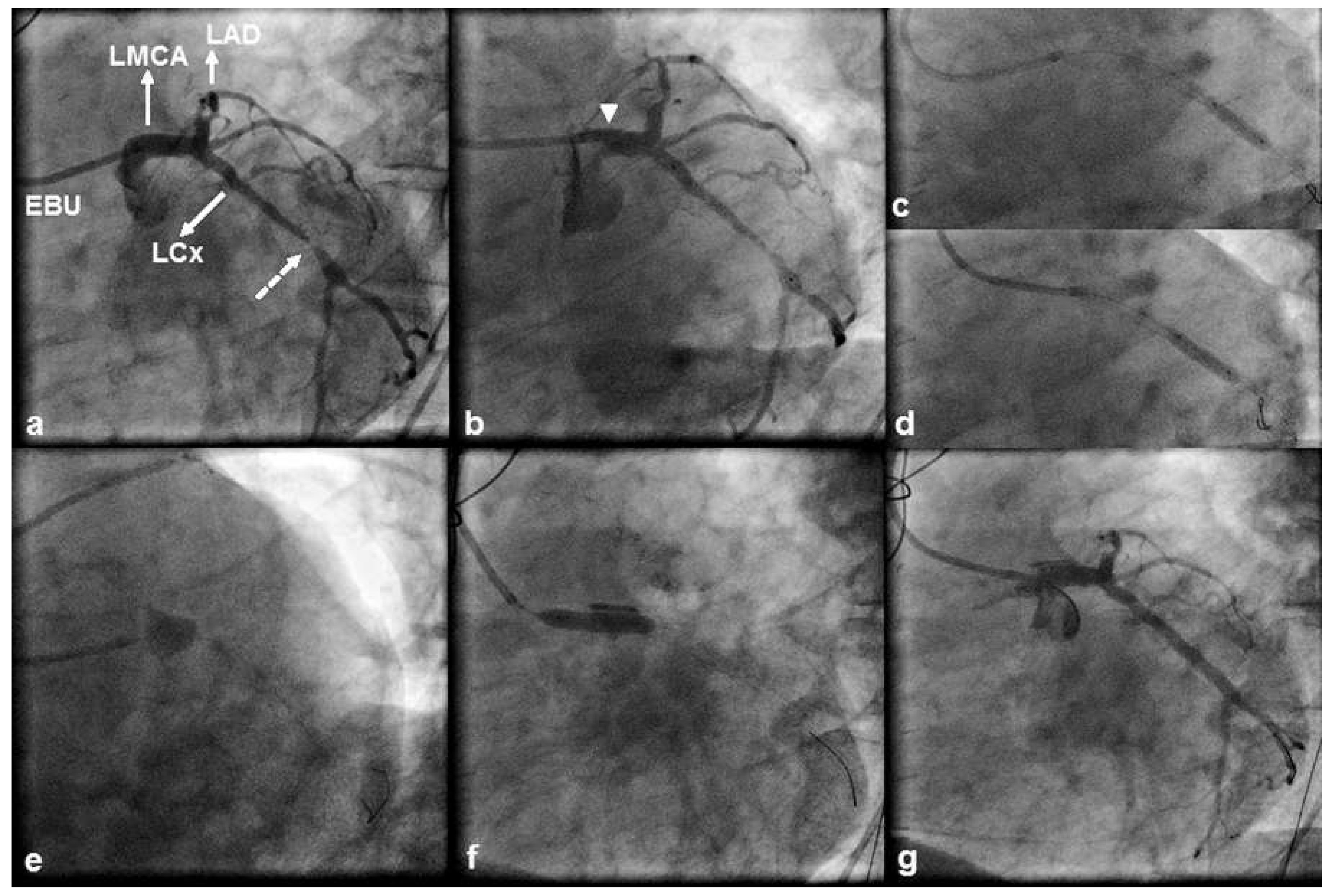 Cardiovascmed 19 00264 g001