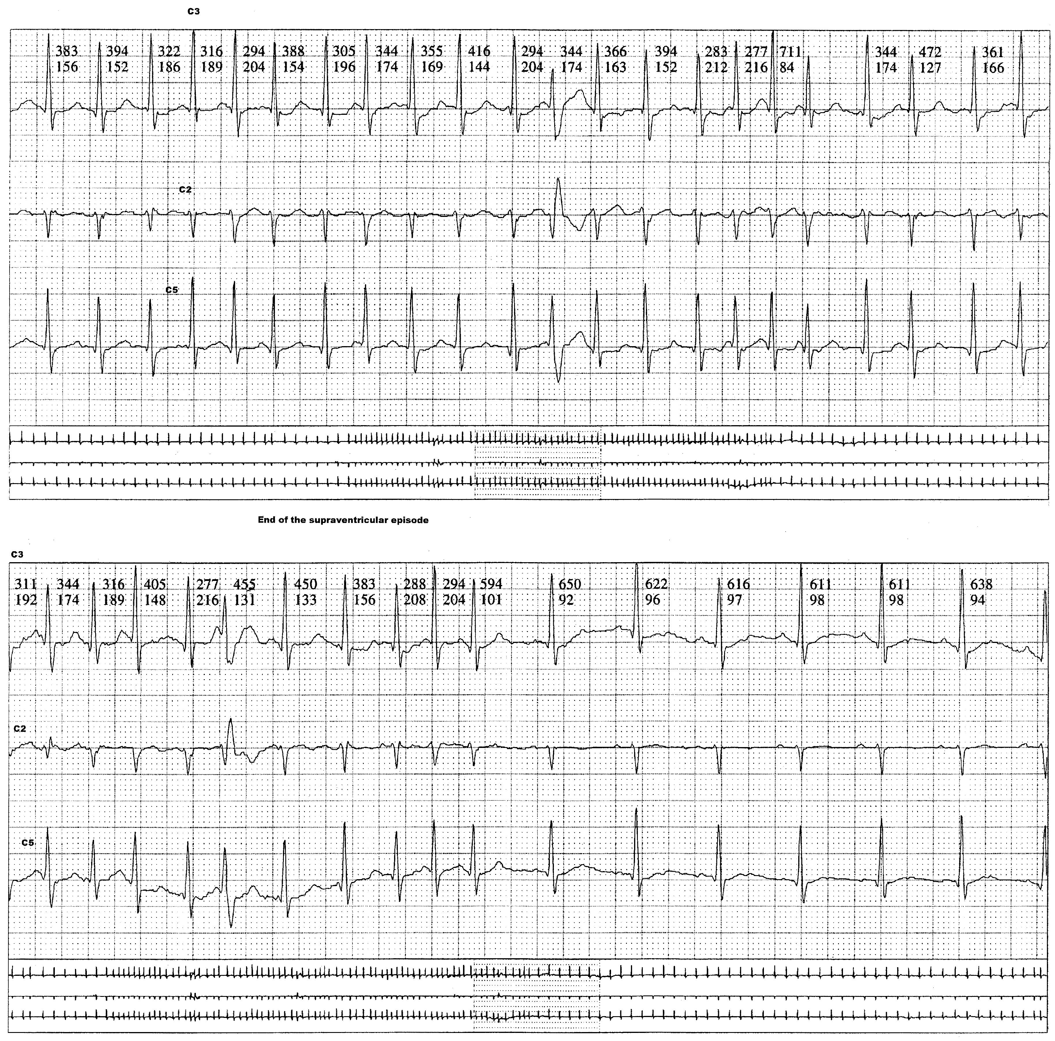 Cardiovascmed 19 00272 g001c Cardiovascmed 19 00272 g001c