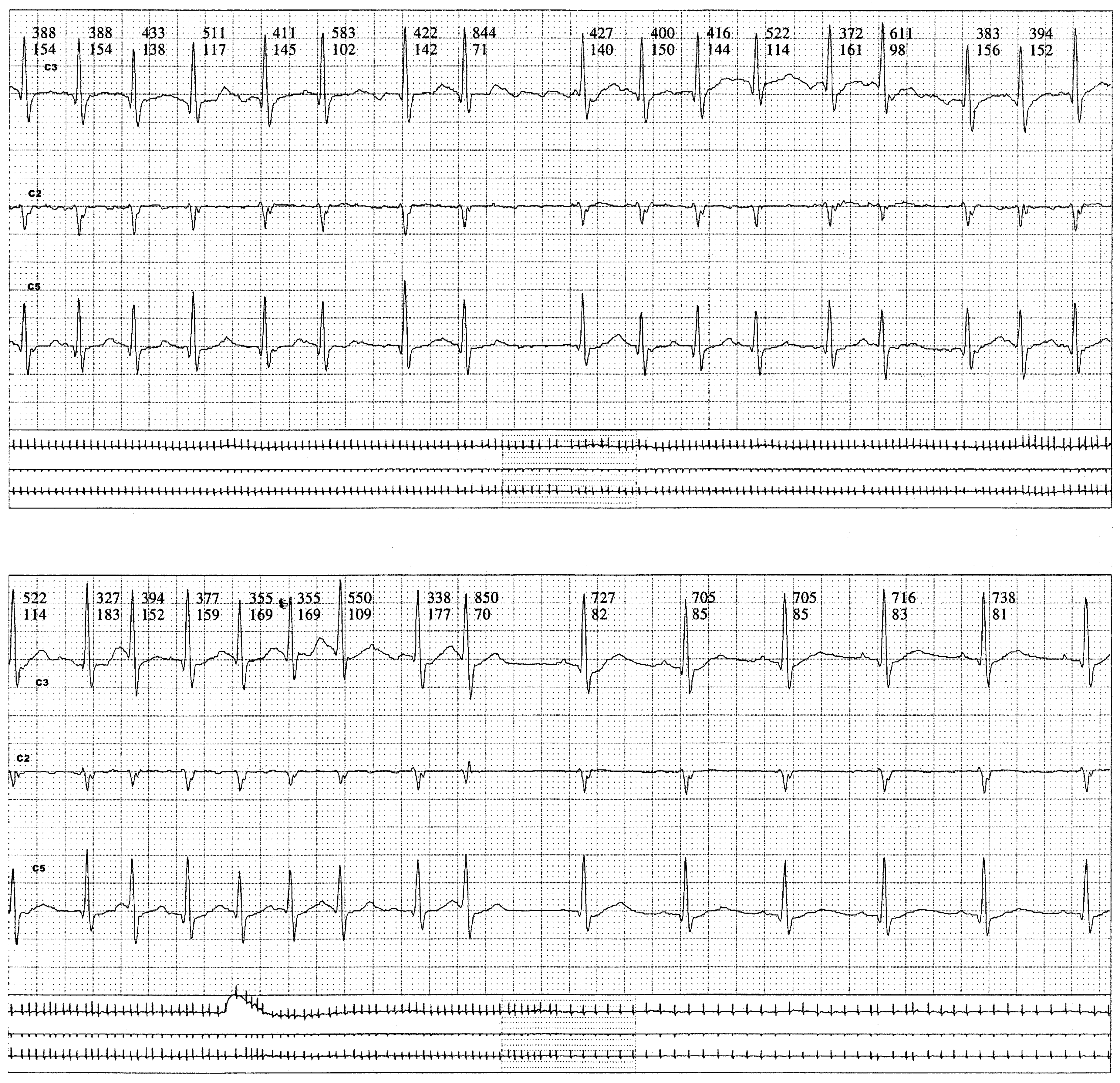 Cardiovascmed 19 00272 g001d Cardiovascmed 19 00272 g001d