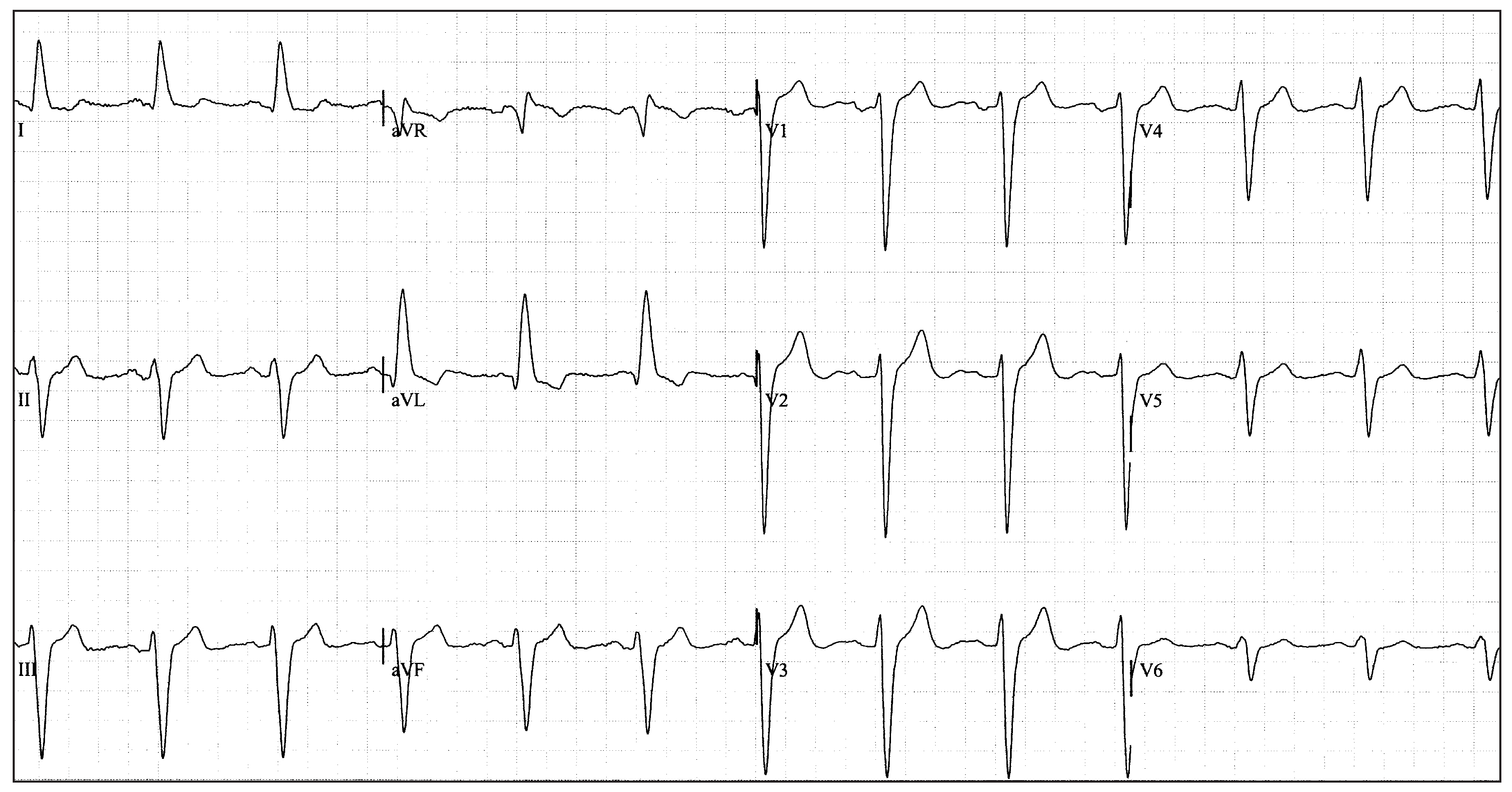Cardiovascmed 19 00272 g003a Cardiovascmed 19 00272 g003a