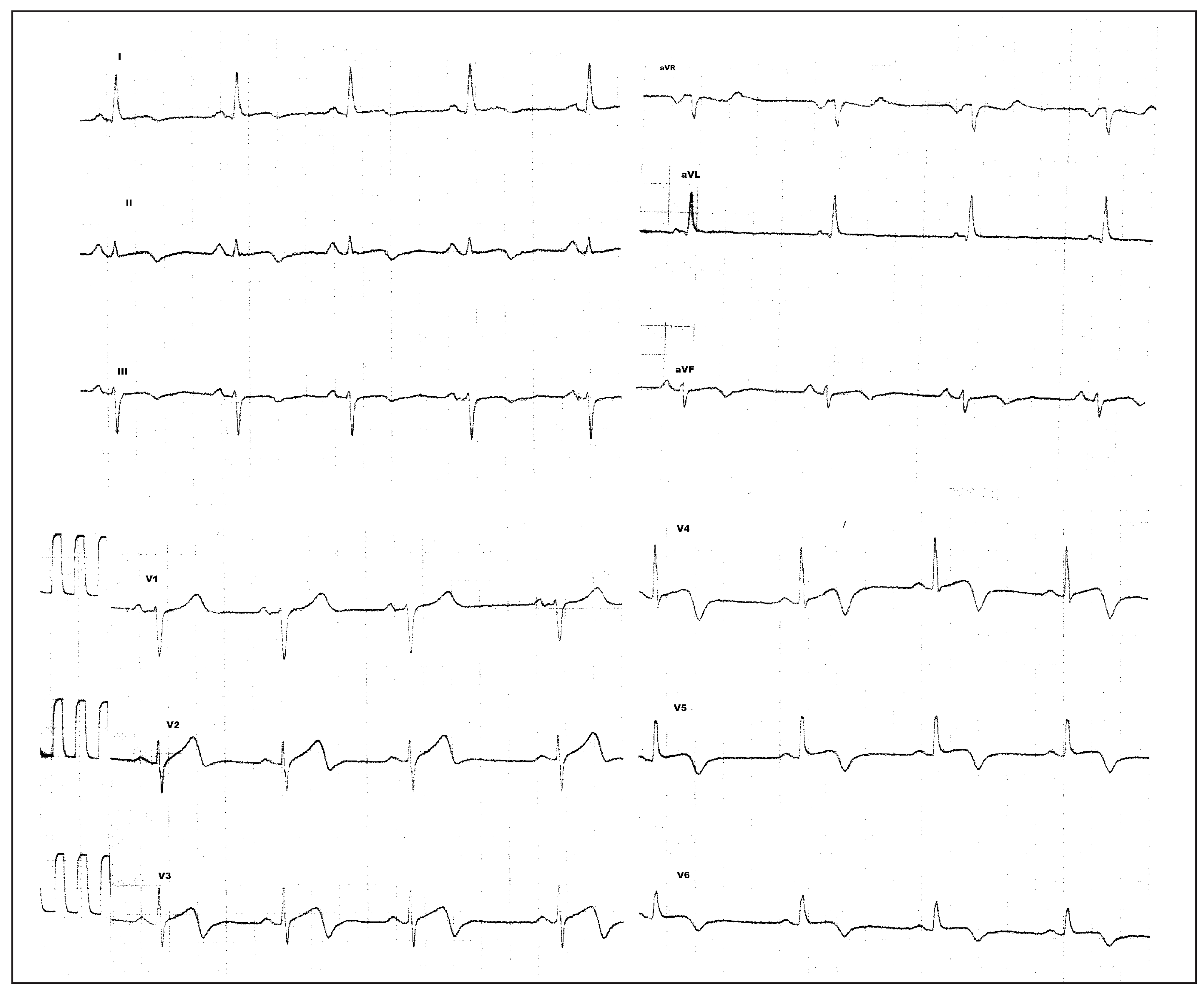 Cardiovascmed 19 00272 g003b Cardiovascmed 19 00272 g003b