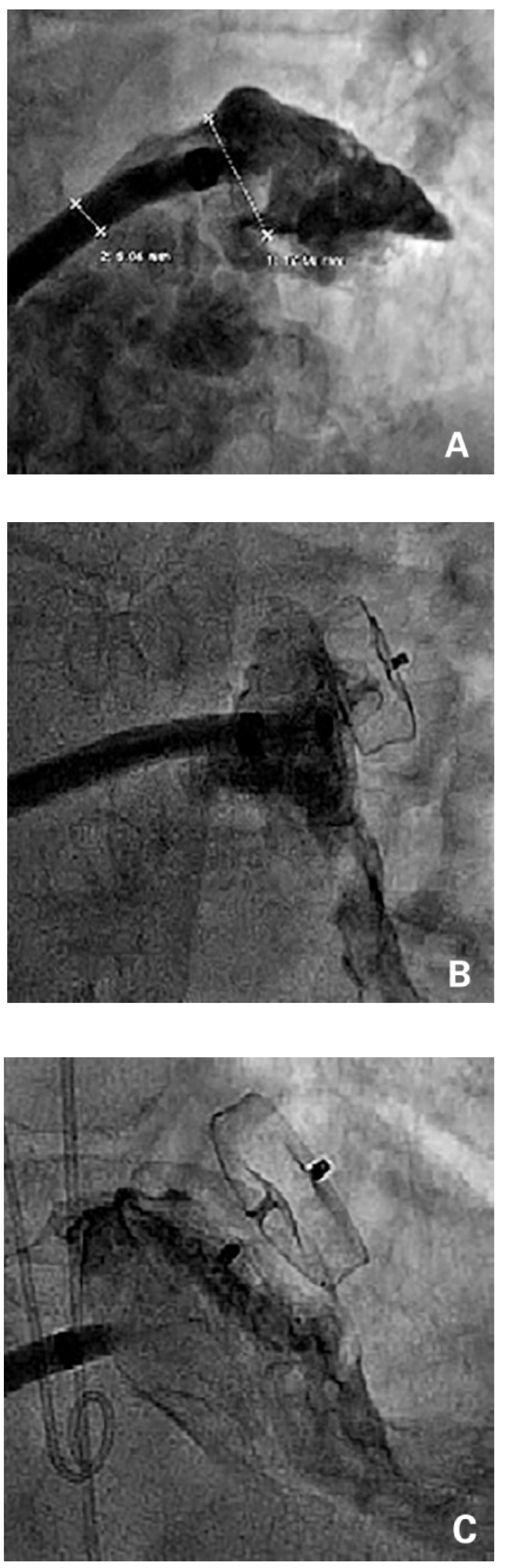 Cardiovascmed 19 00288 g002