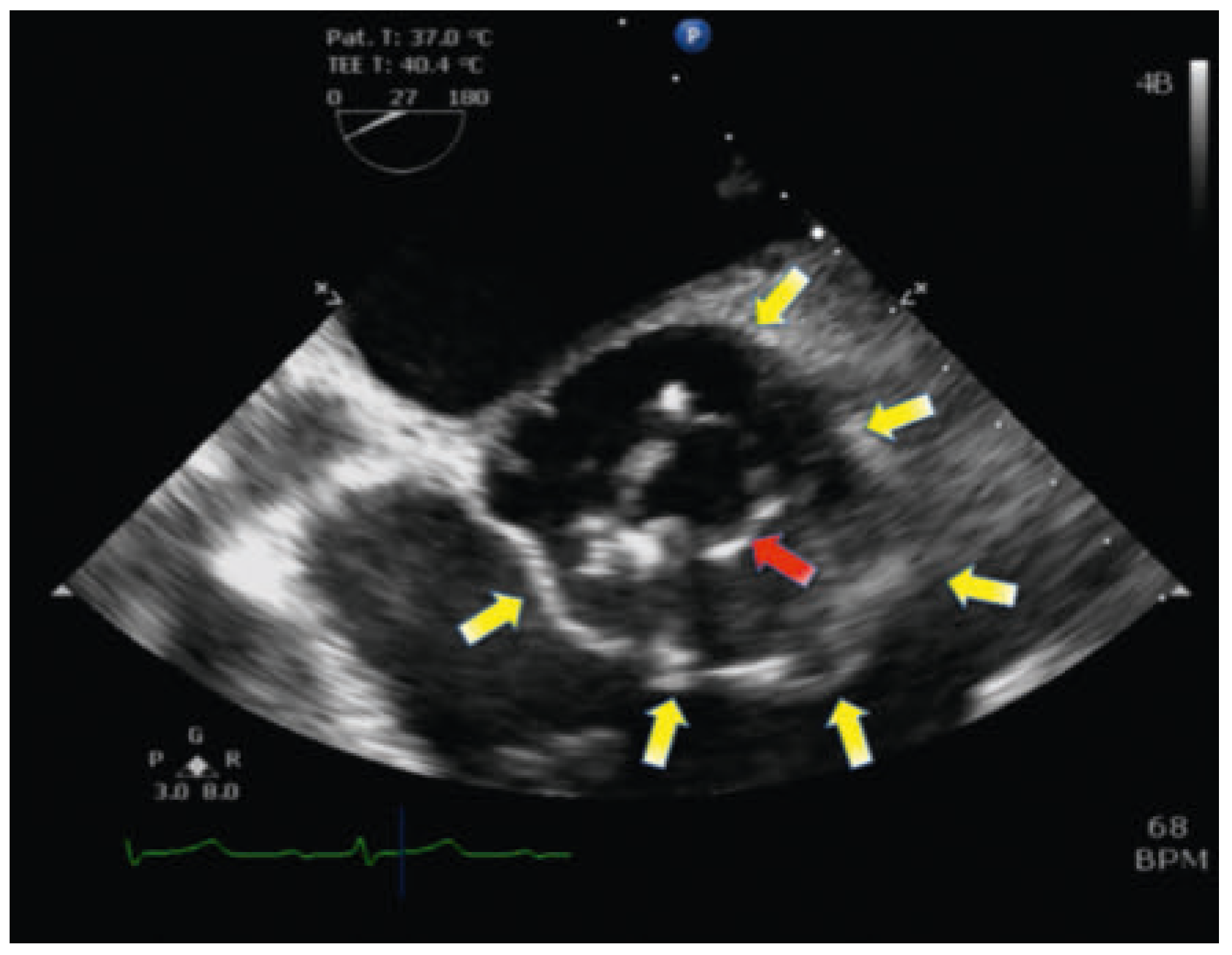 Cardiovascmed 19 00328 g001