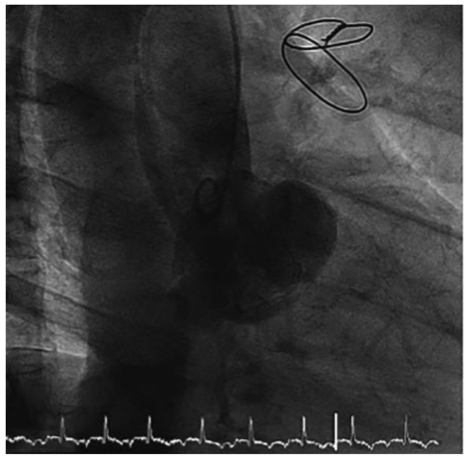 Cardiovascmed 19 00328 g002