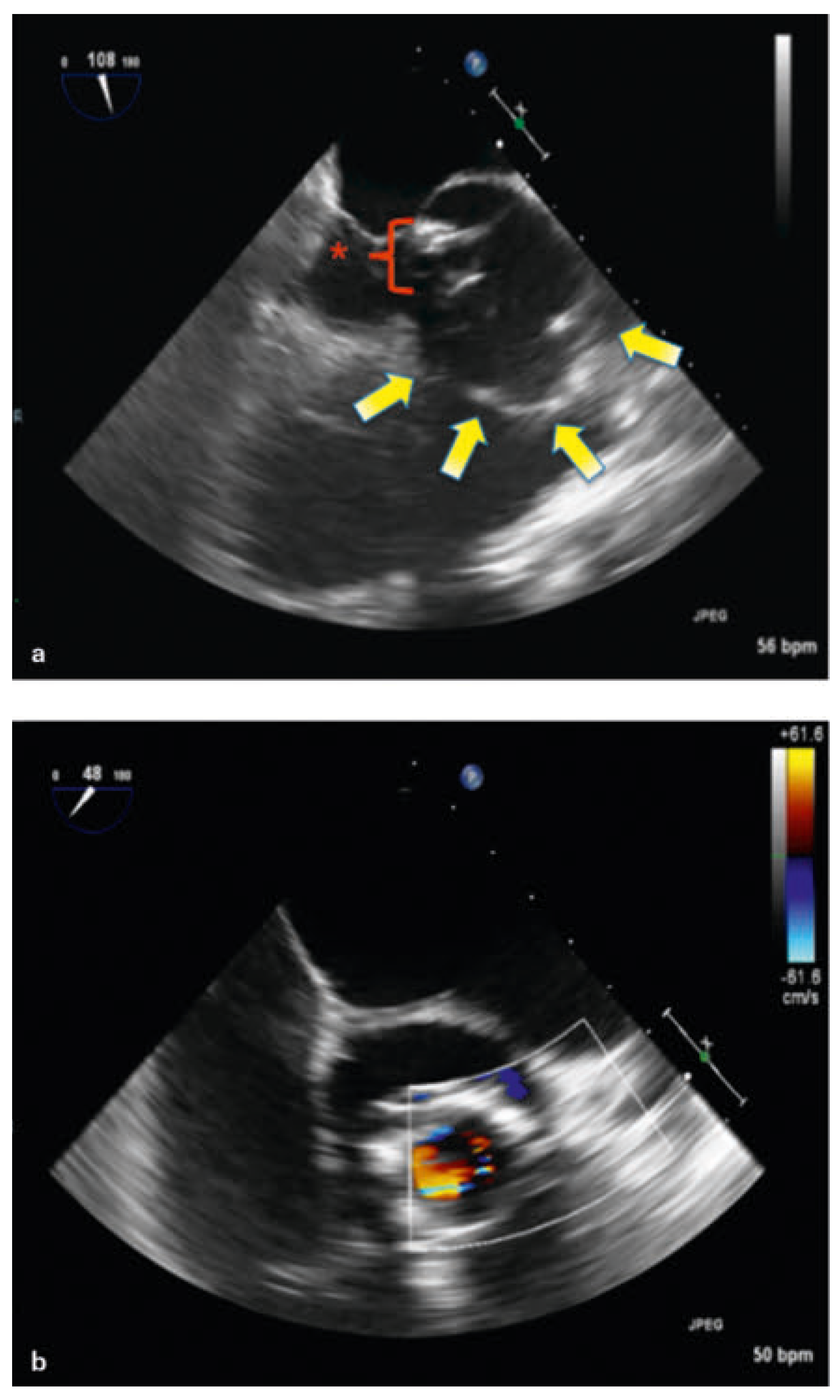 Cardiovascmed 19 00328 g003