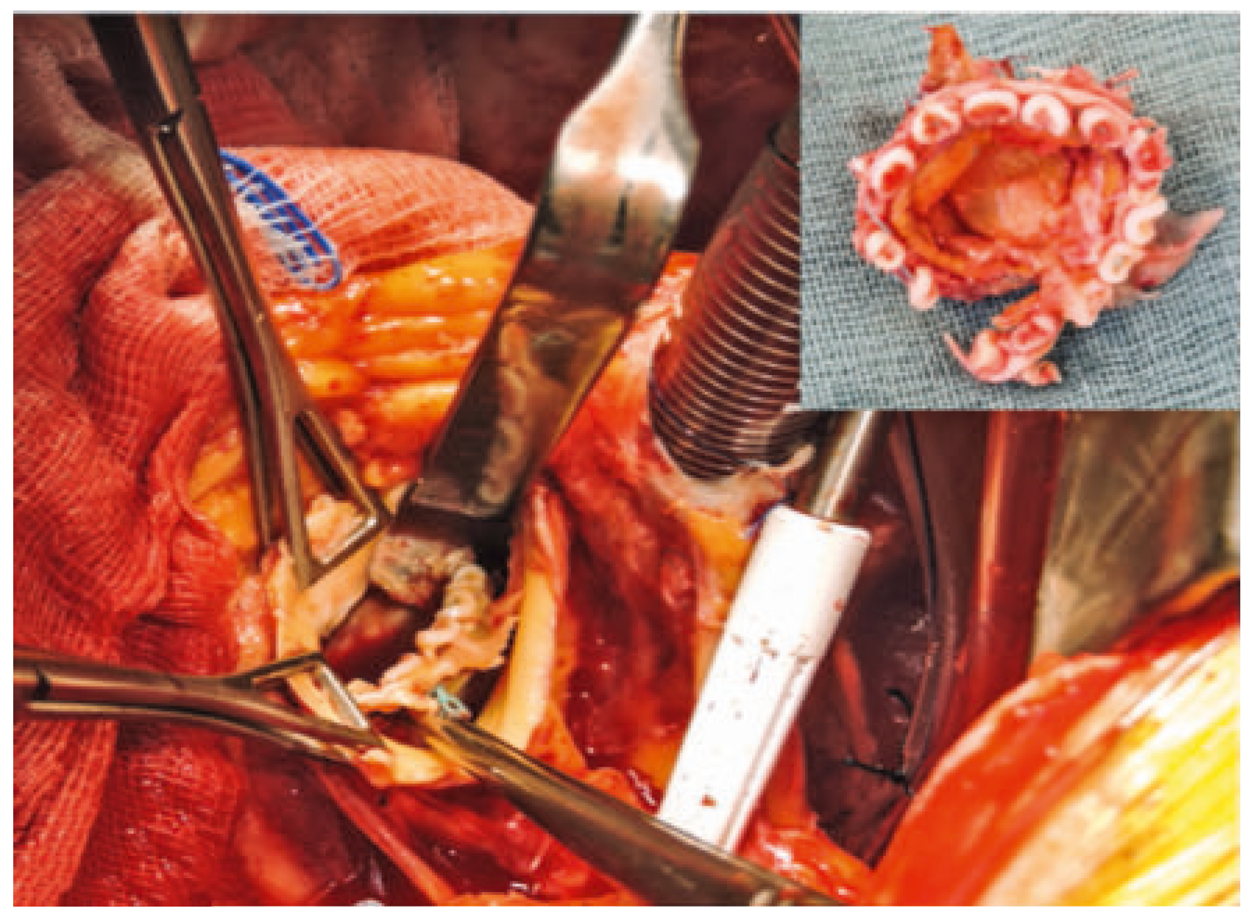 Cardiovascmed 19 00328 g004