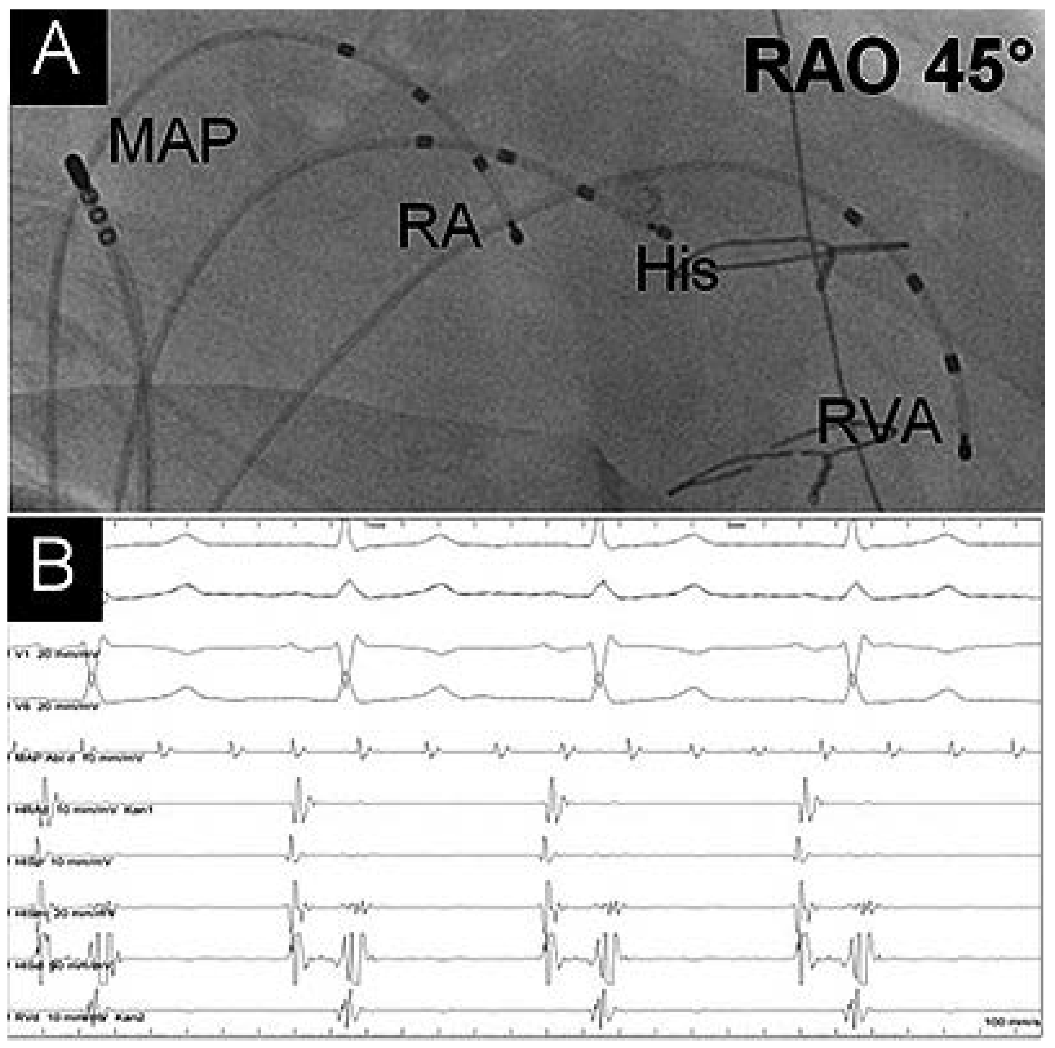 Cardiovascmed 19 00332 g002 Cardiovascmed 19 00332 g002