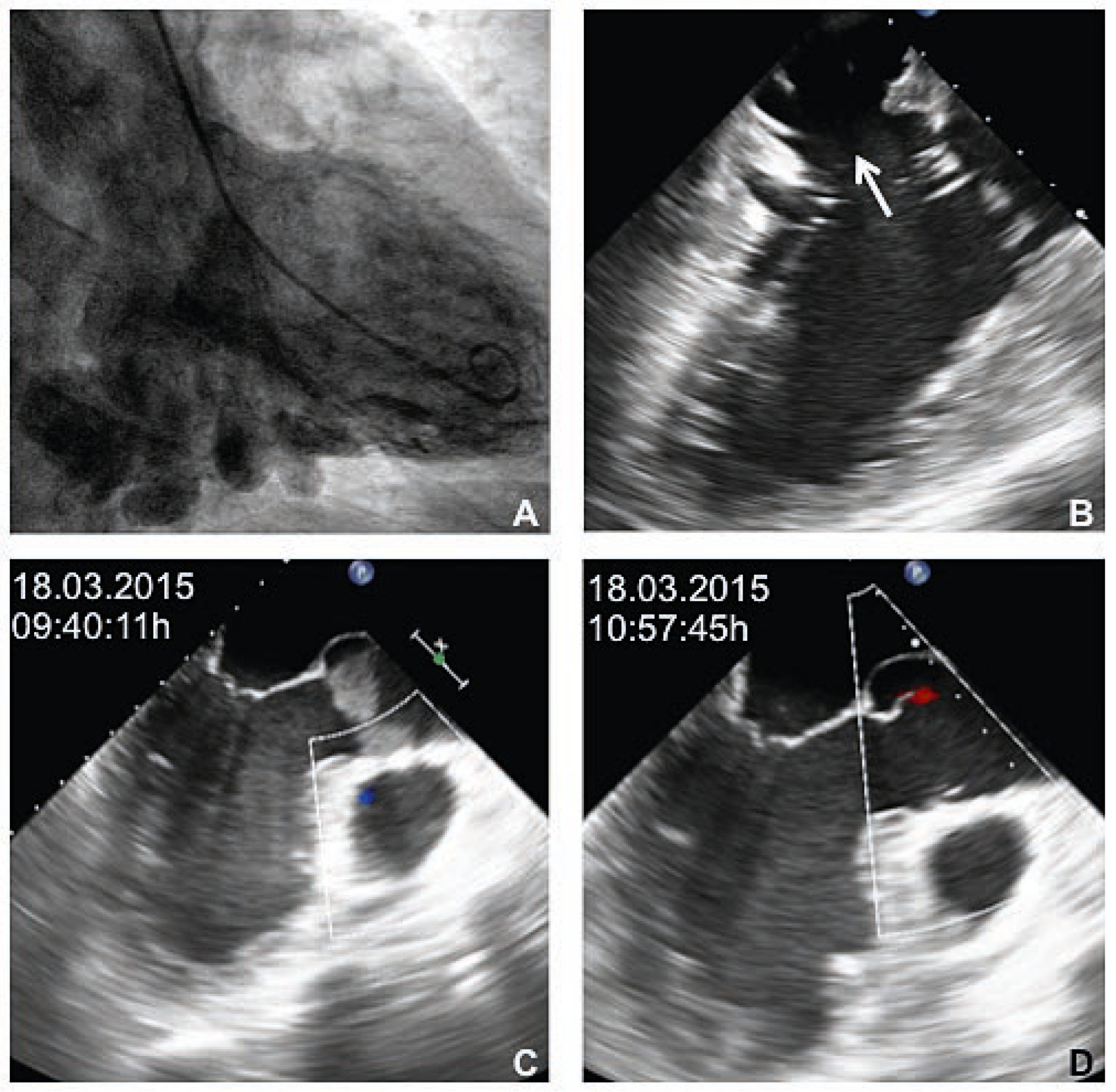 Cardiovascmed 19 00335 g001