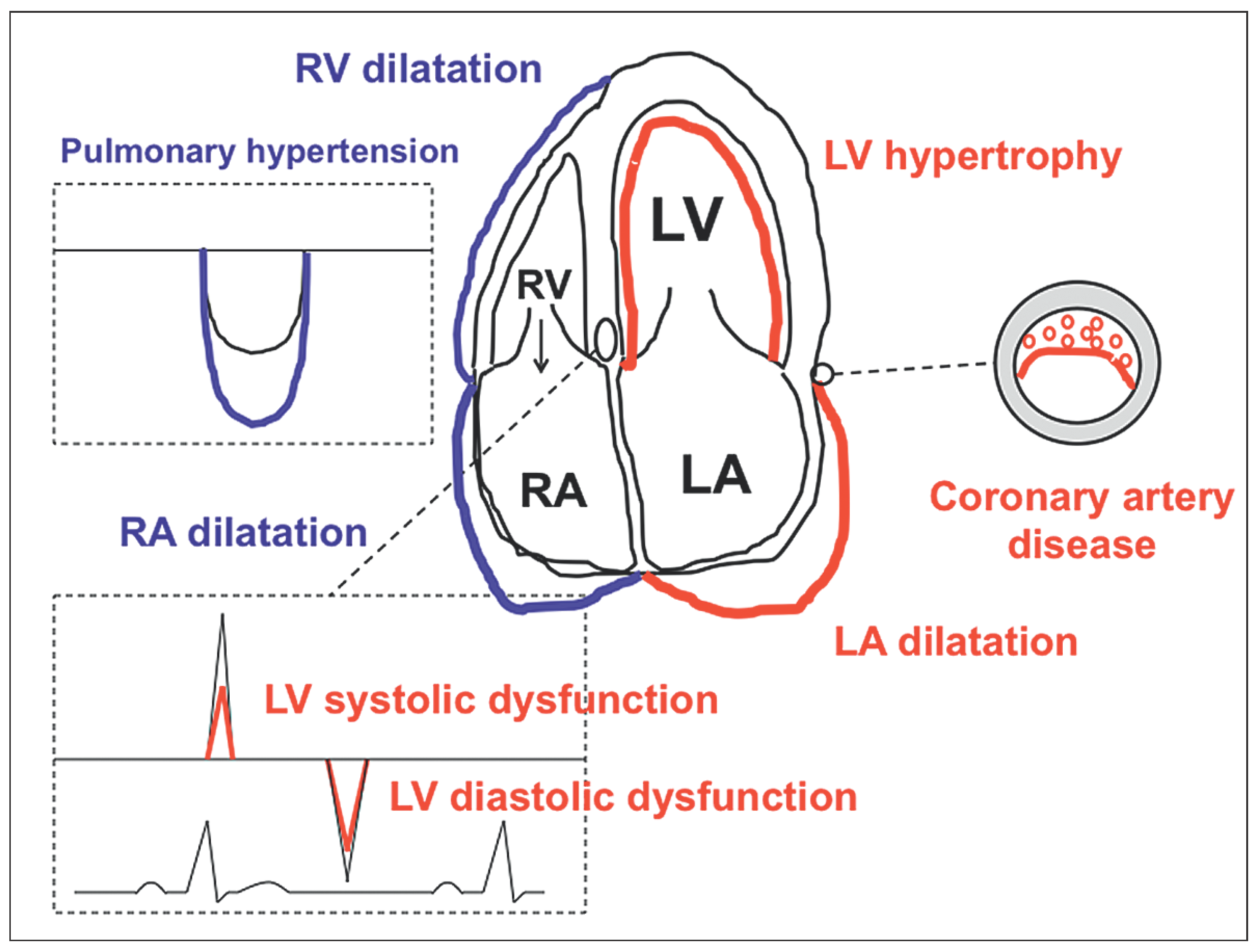 Cardiovascmed 20 00009 g001