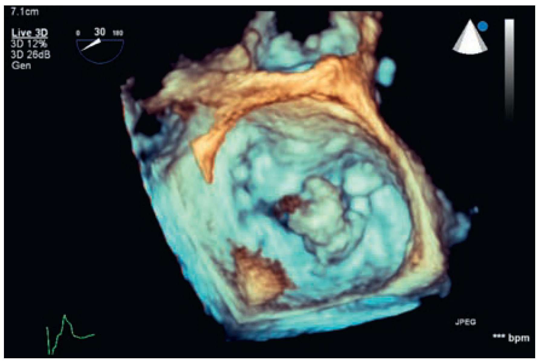 Cardiovascmed 20 00022 g001