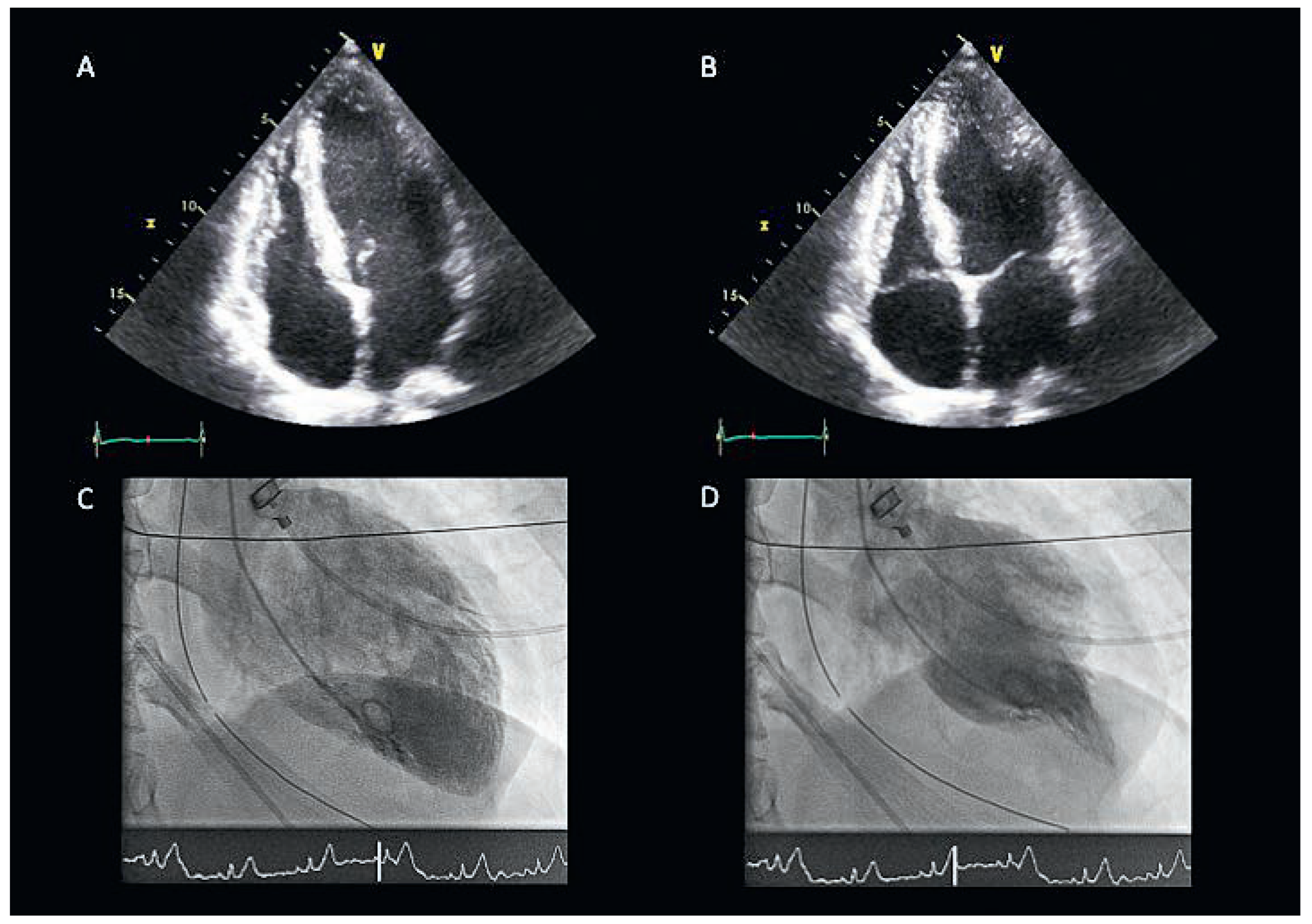 Cardiovascmed 20 00024 g001 Cardiovascmed 20 00024 g001