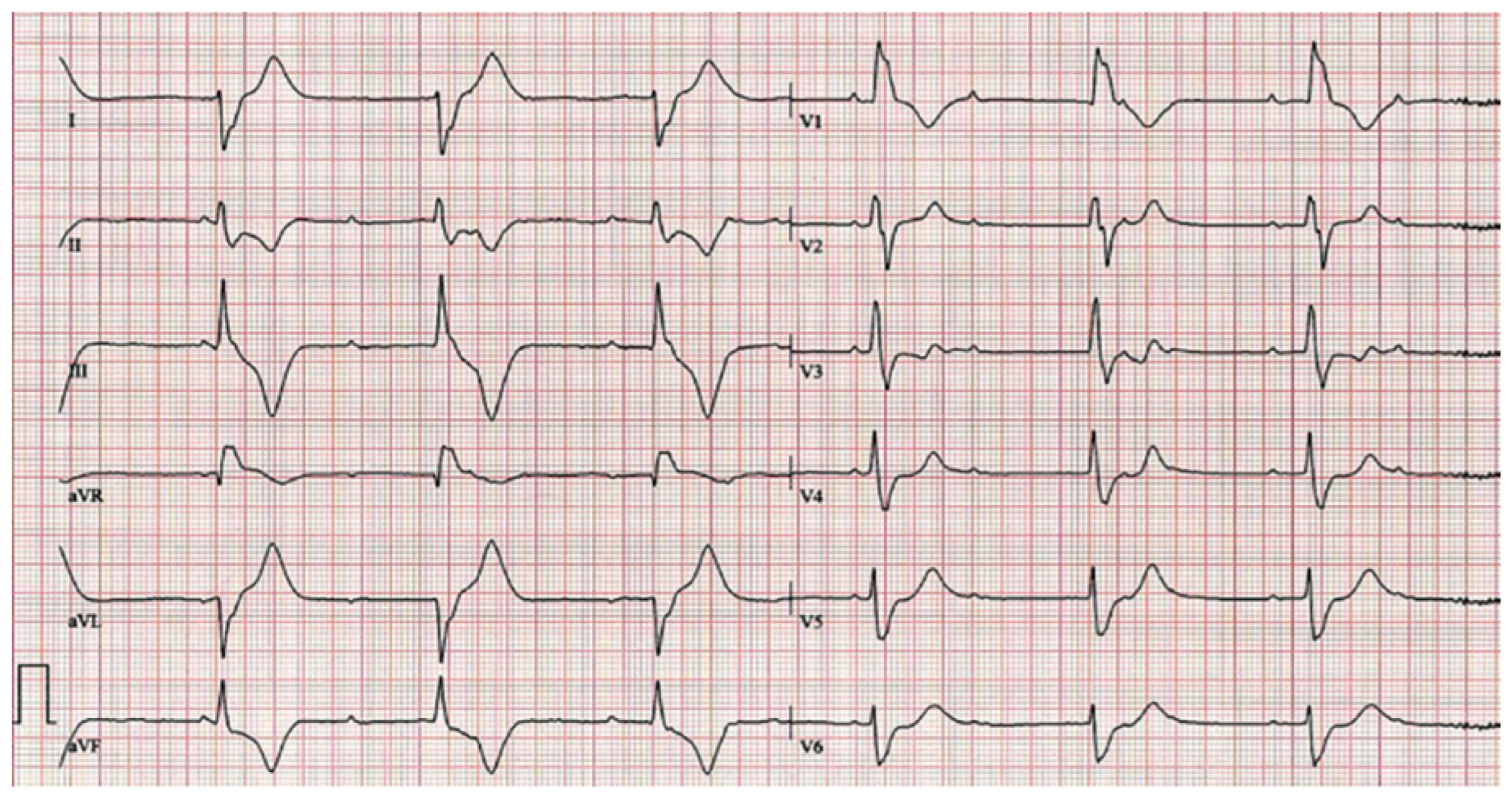 Cardiovascmed 20 00046 g002 Cardiovascmed 20 00046 g002
