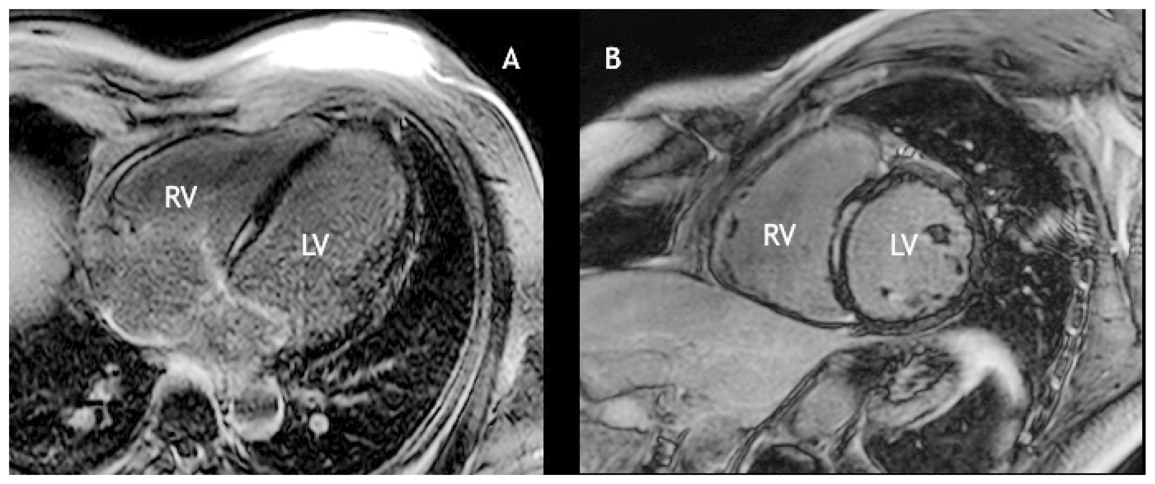 Cardiovascmed 20 00046 g003 Cardiovascmed 20 00046 g003