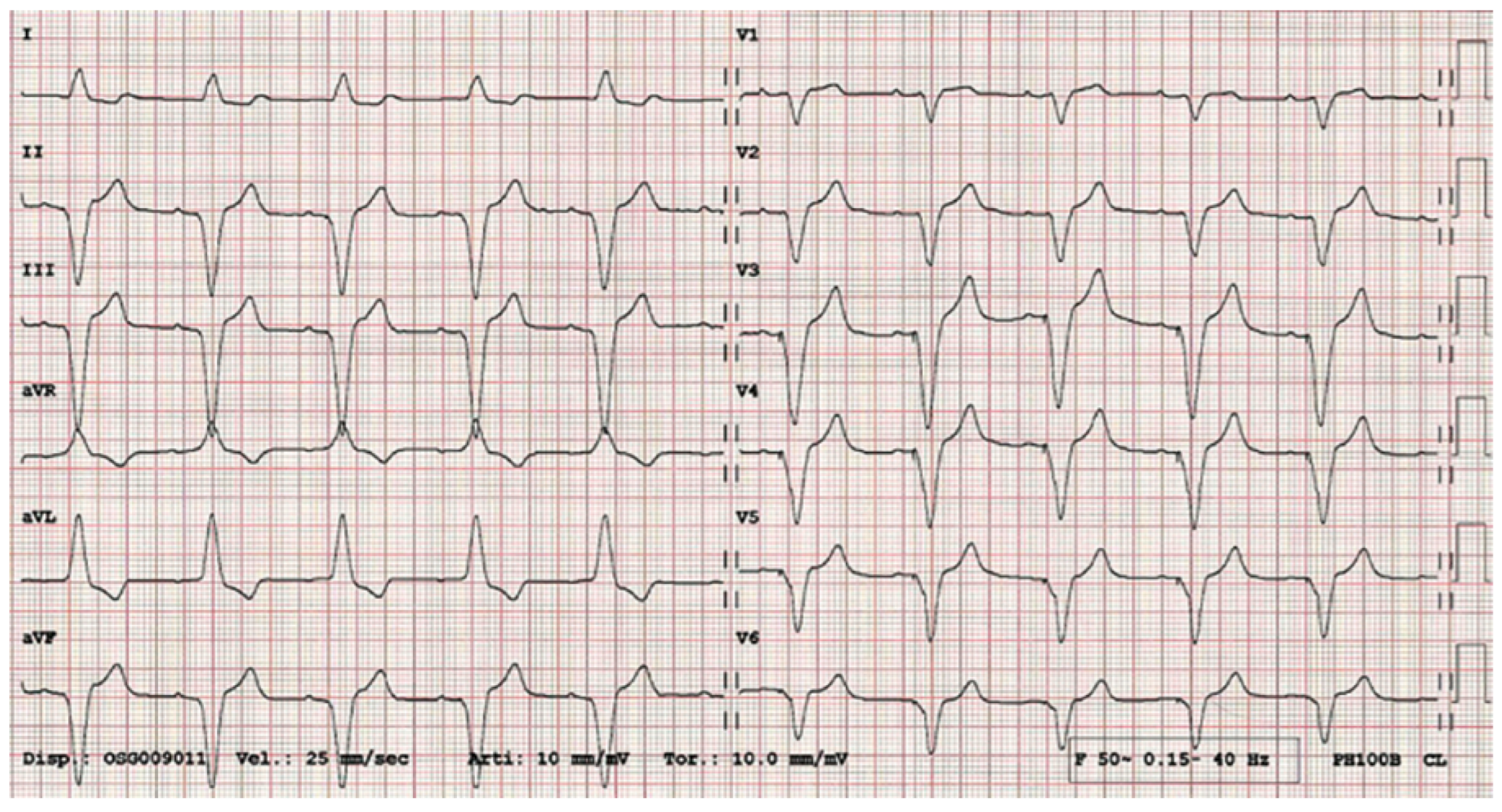 Cardiovascmed 20 00046 g004 Cardiovascmed 20 00046 g004