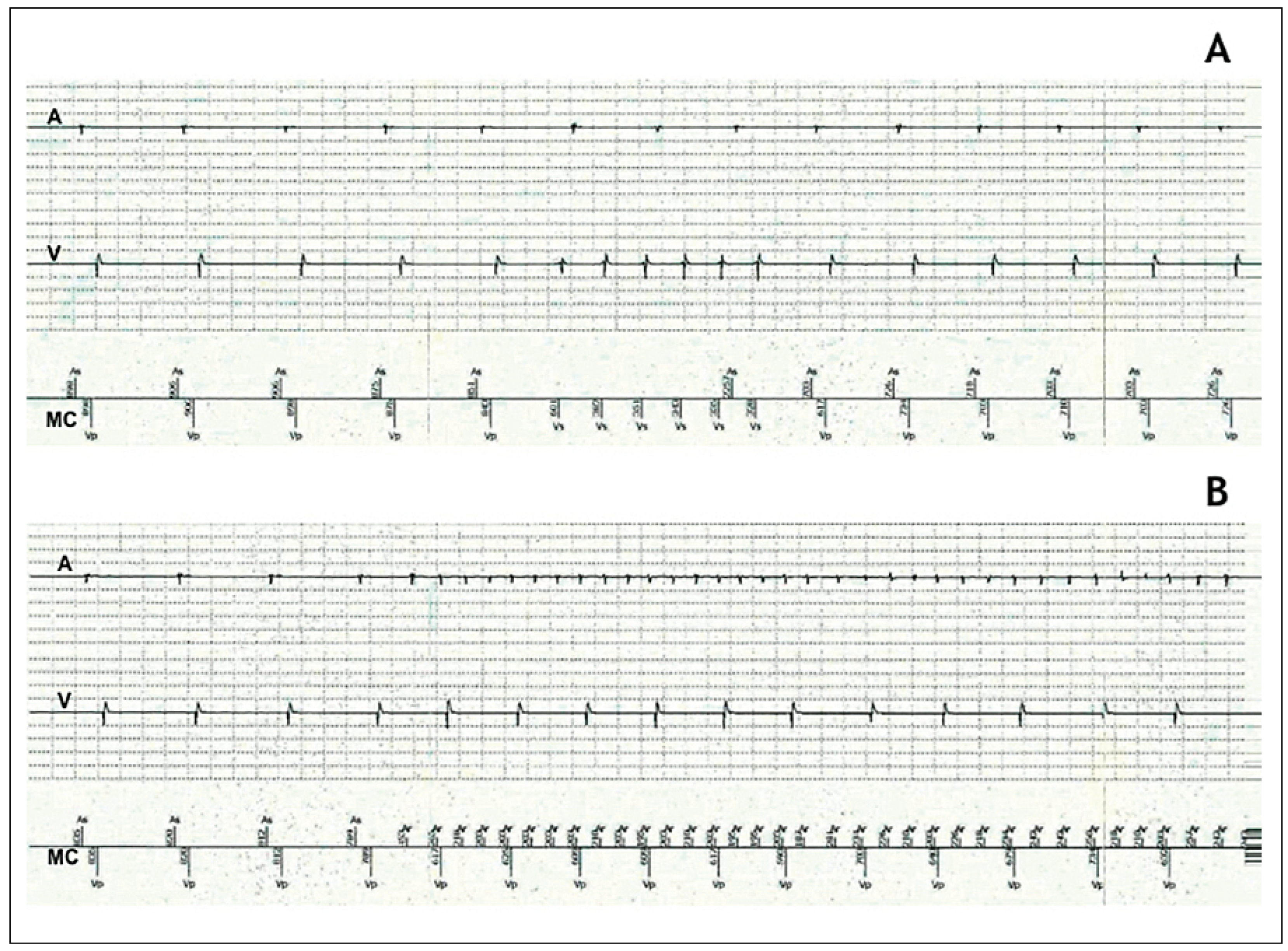 Cardiovascmed 20 00046 g005 Cardiovascmed 20 00046 g005