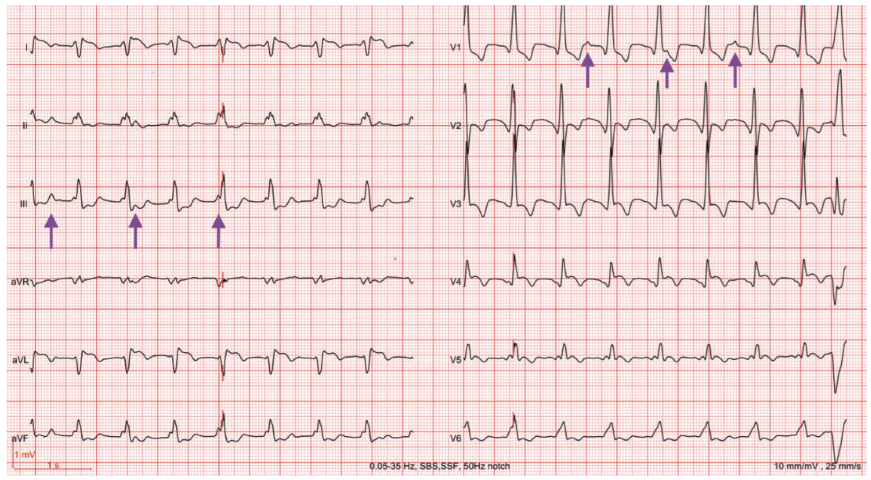 Cardiovascmed 20 00074 g002