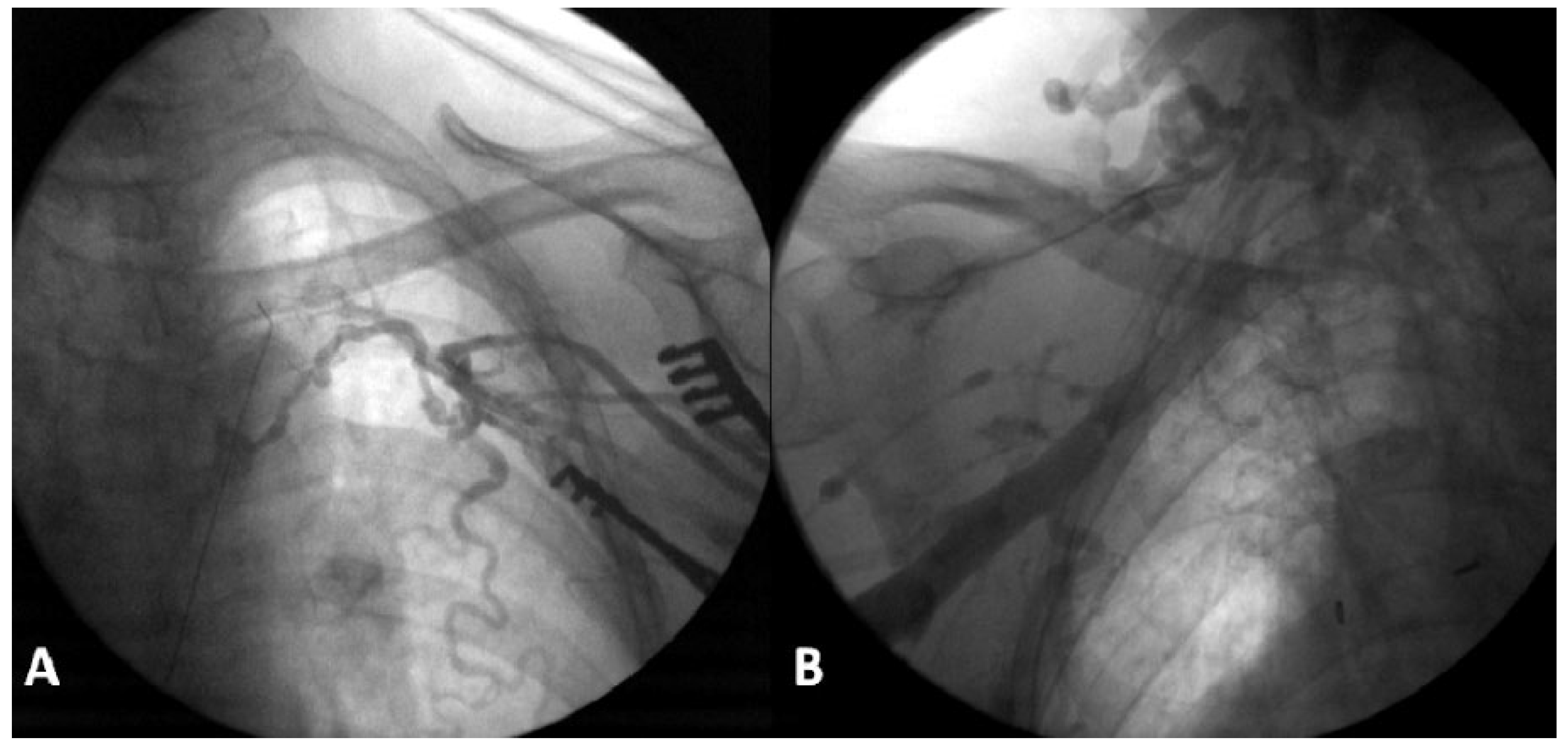 Cardiovascmed 20 00101 g001