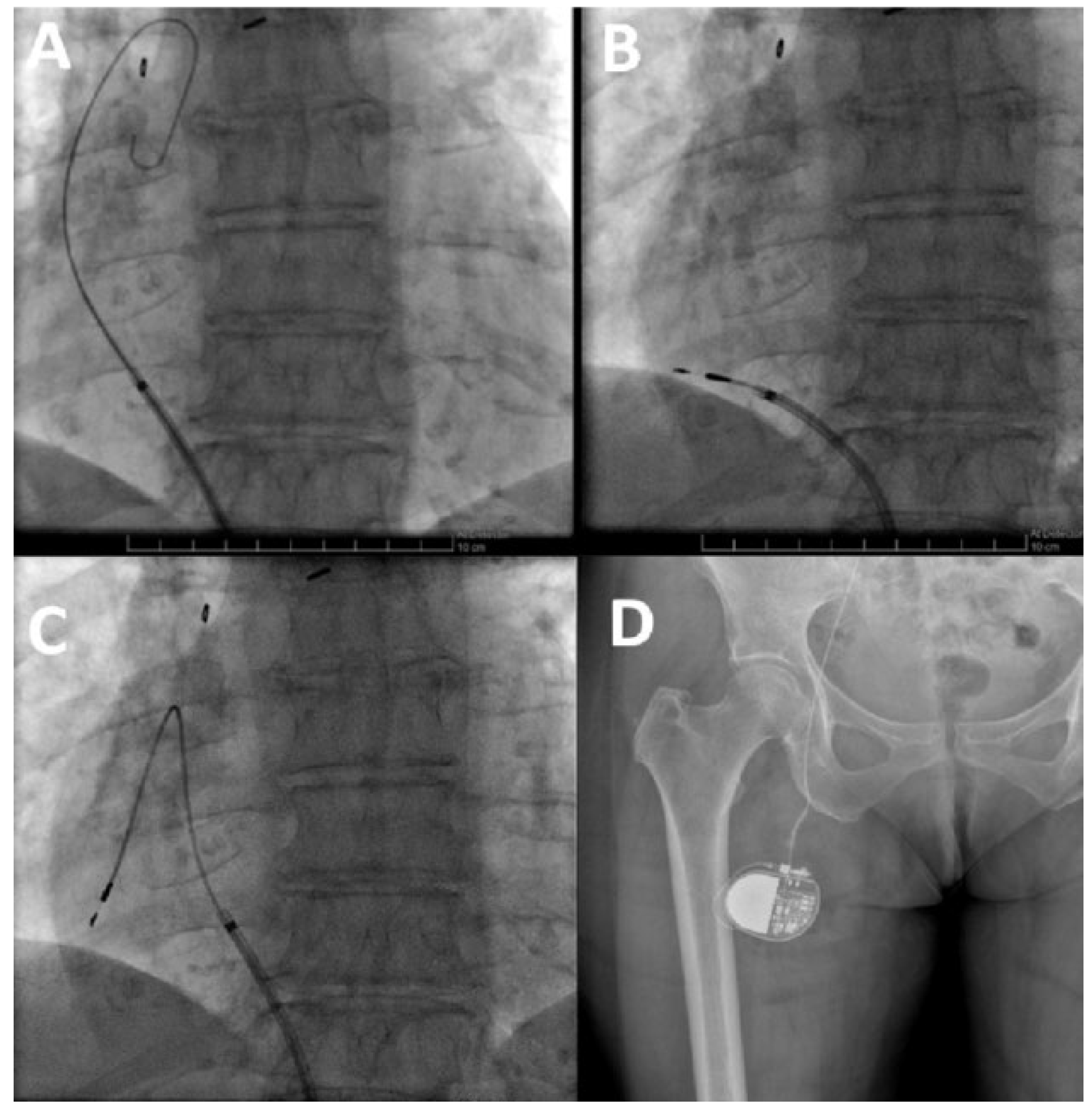 Cardiovascmed 20 00101 g002
