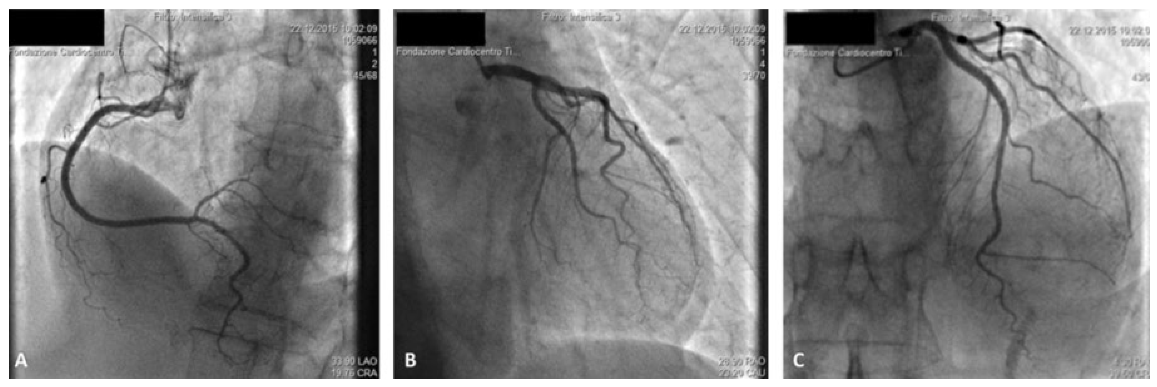 Cardiovascmed 20 00105 g002 Cardiovascmed 20 00105 g002