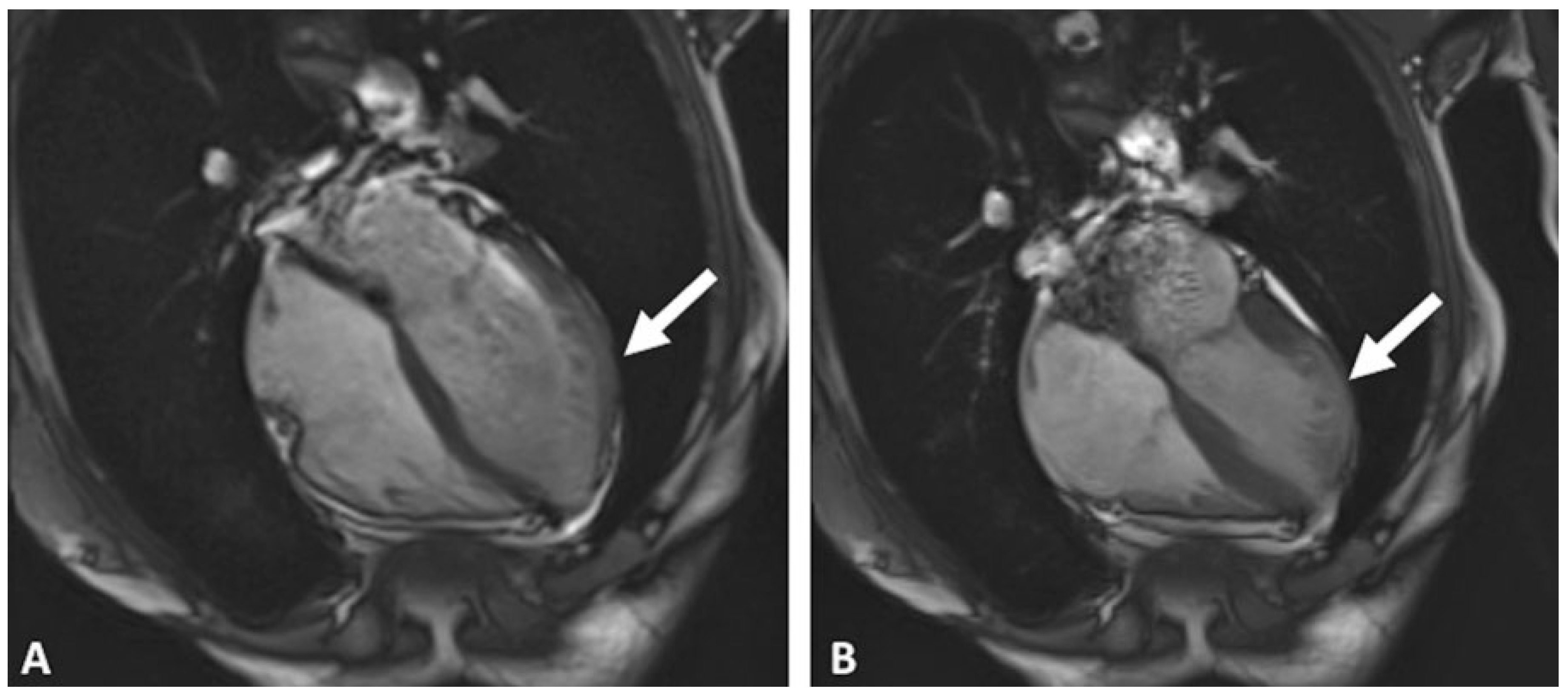 Cardiovascmed 20 00105 g003 Cardiovascmed 20 00105 g003