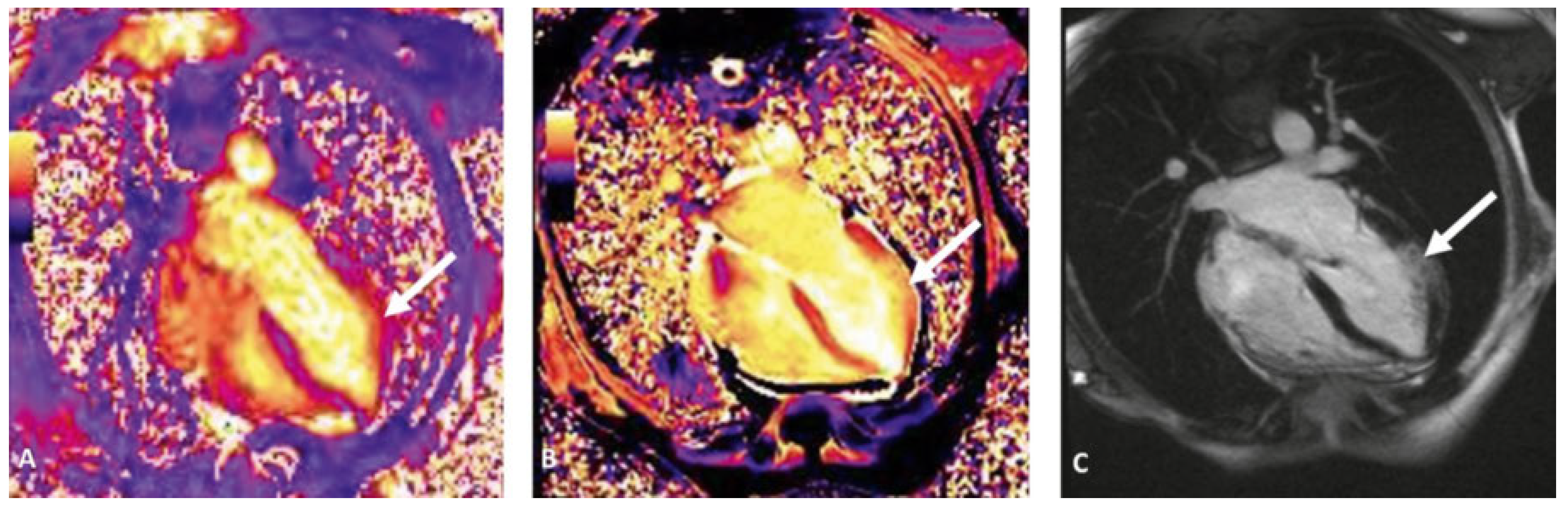 Cardiovascmed 20 00105 g004 Cardiovascmed 20 00105 g004
