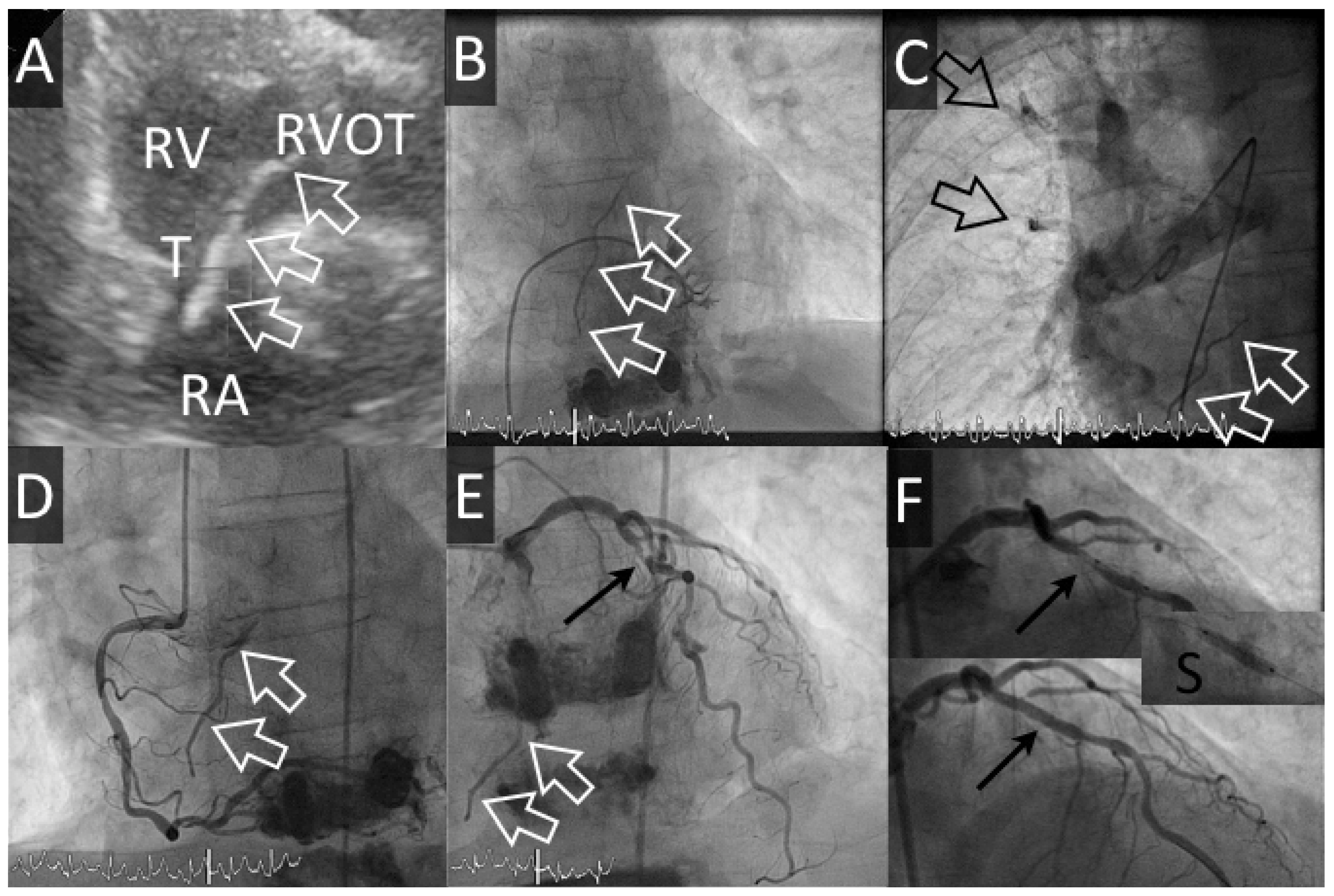 Cardiovascmed 20 00132 g002