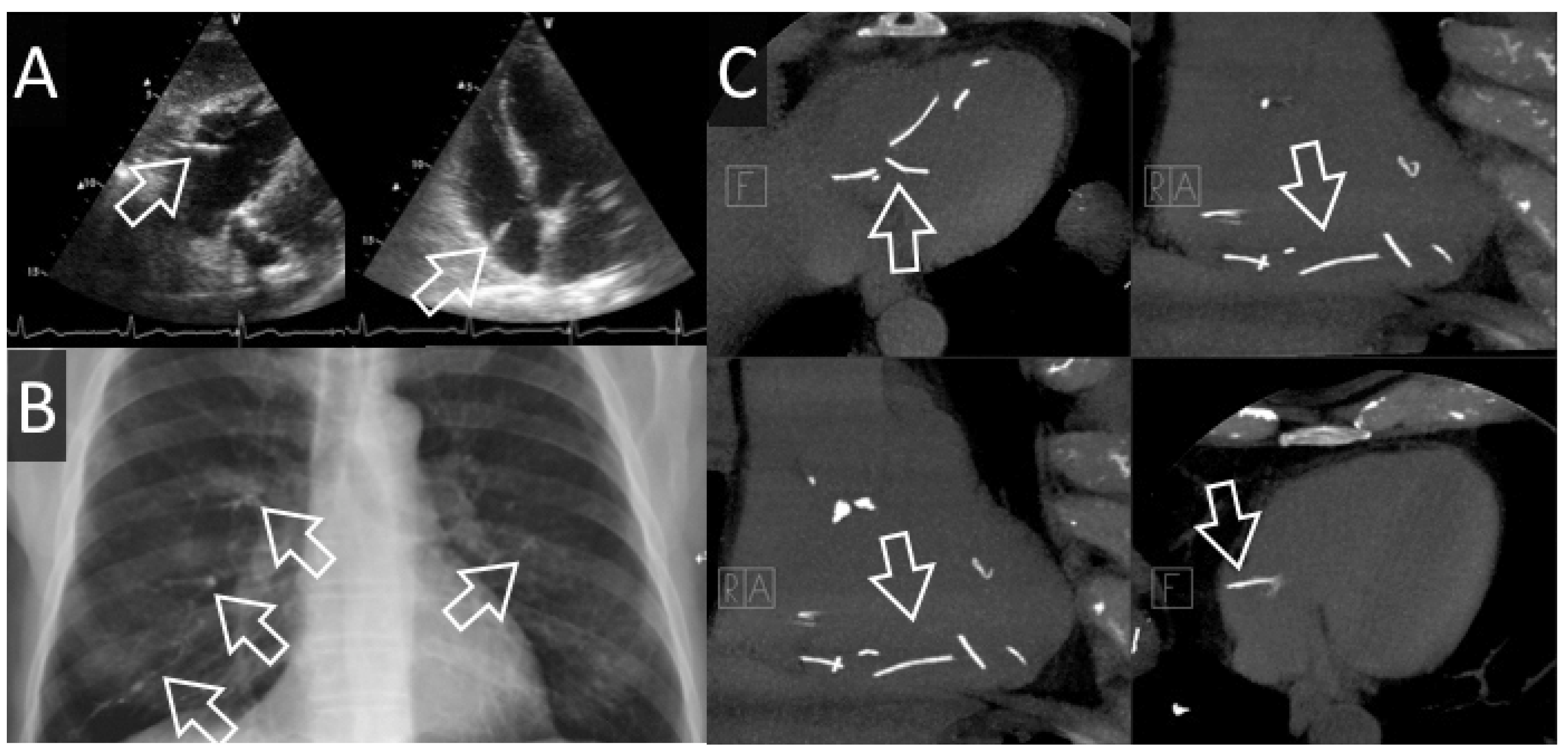 Cardiovascmed 20 00132 g003