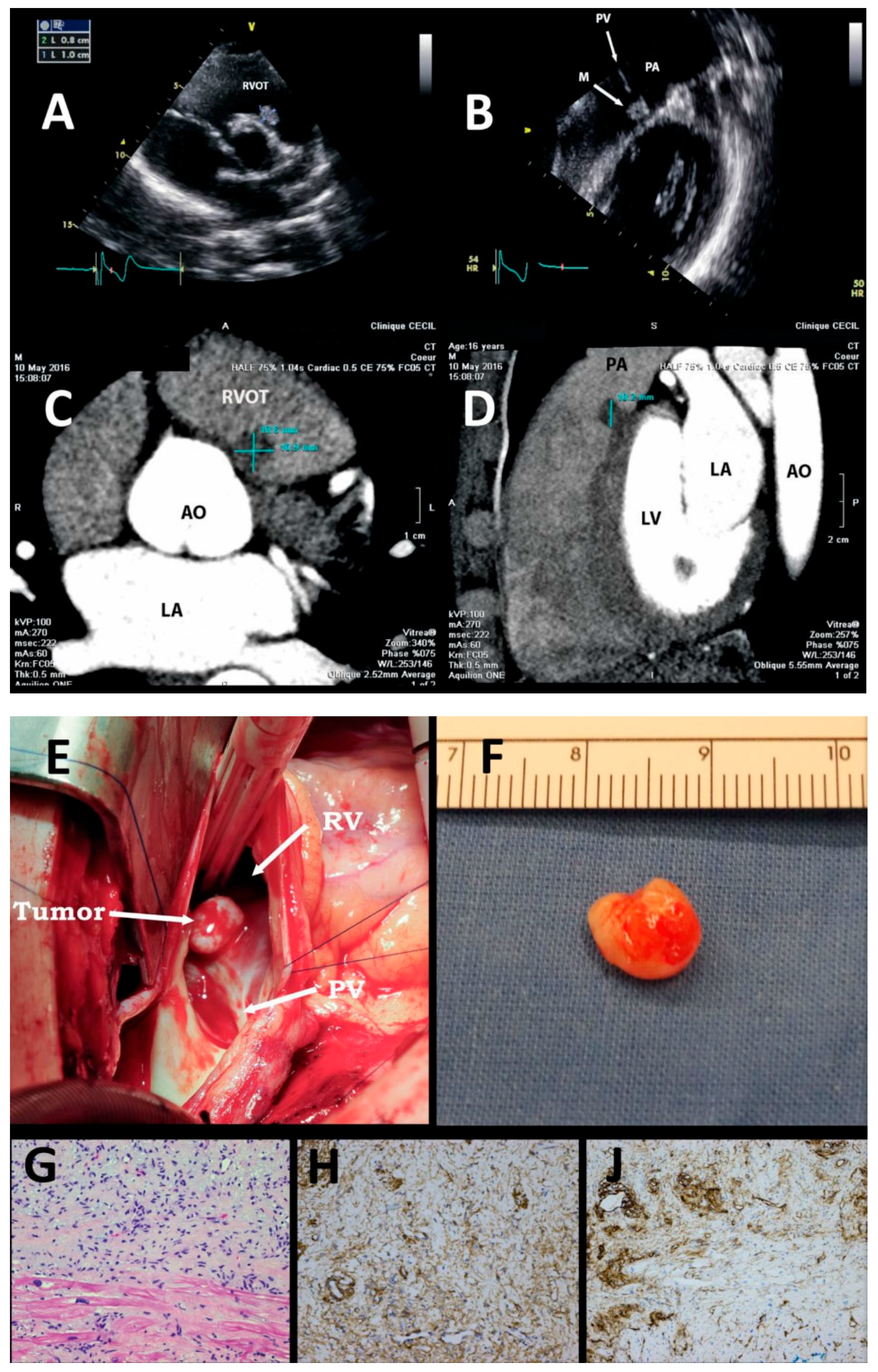 Cardiovascmed 20 00136 g001