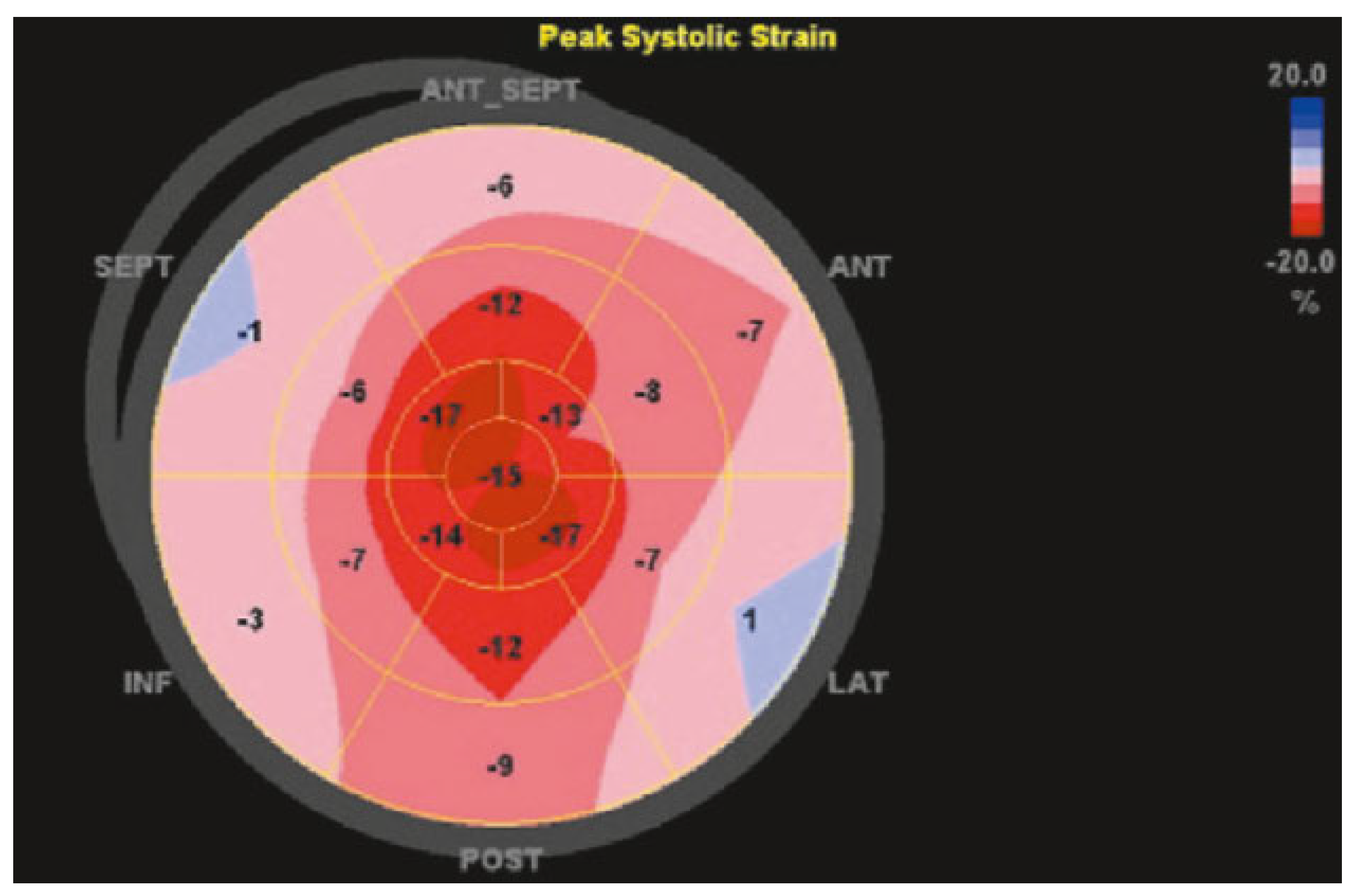 Cardiovascmed 20 00146 g001