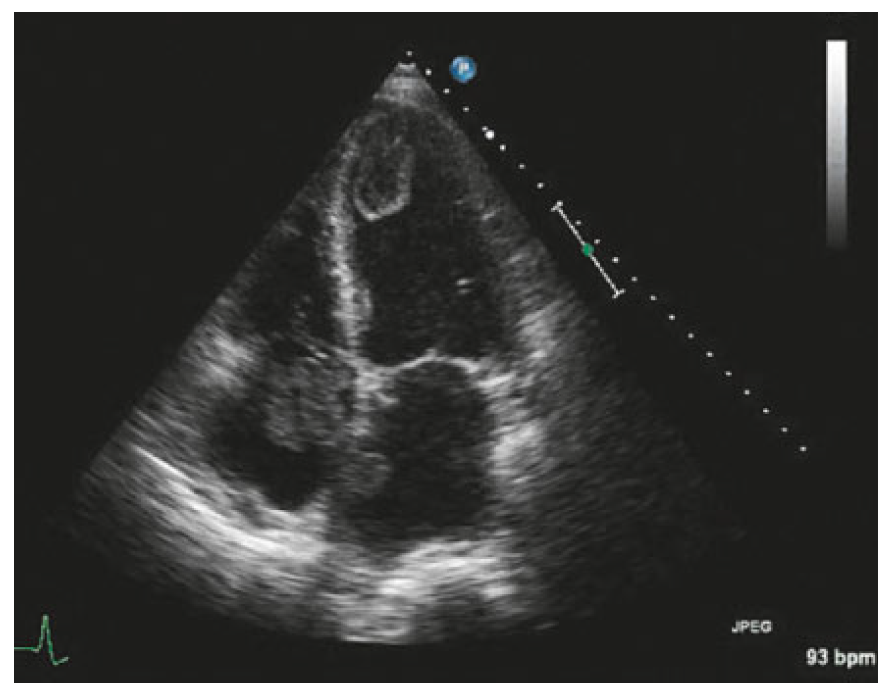 Cardiovascmed 20 00146 g002