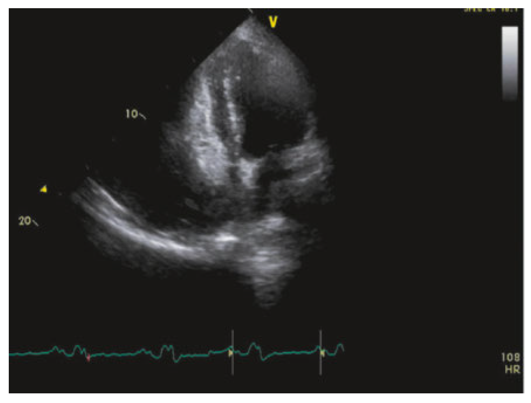 Cardiovascmed 20 00146 g006