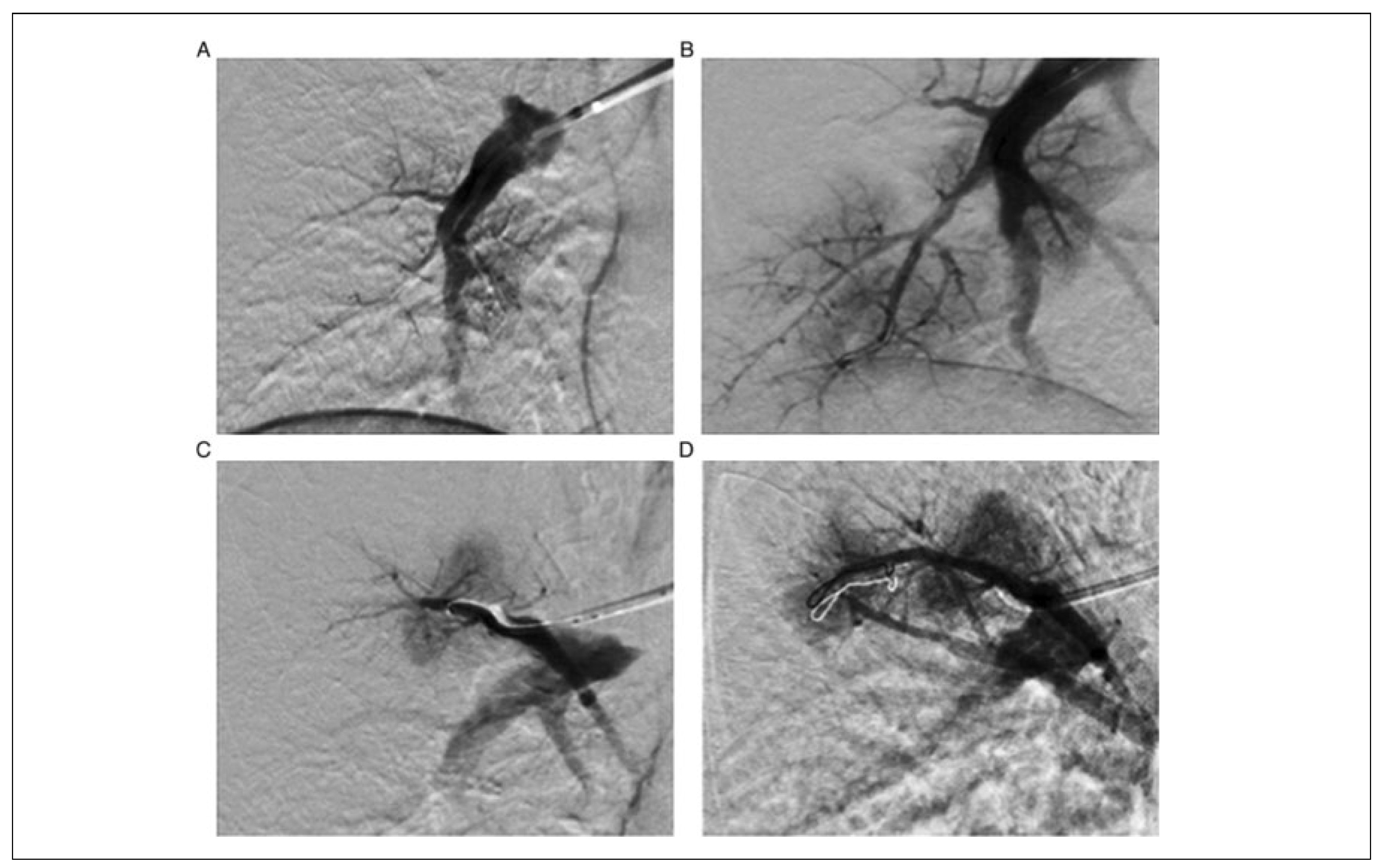 Cardiovascmed 20 00154 g002 Cardiovascmed 20 00154 g002