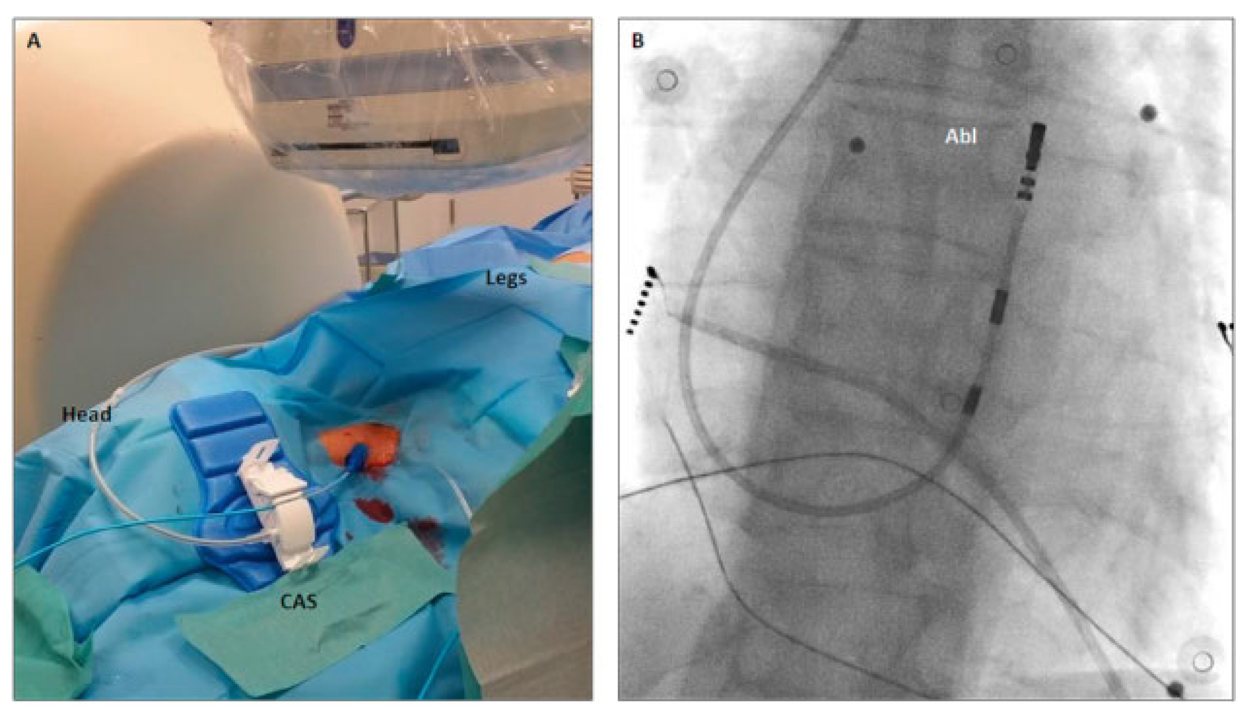 Cardiovascmed 20 00160 g001