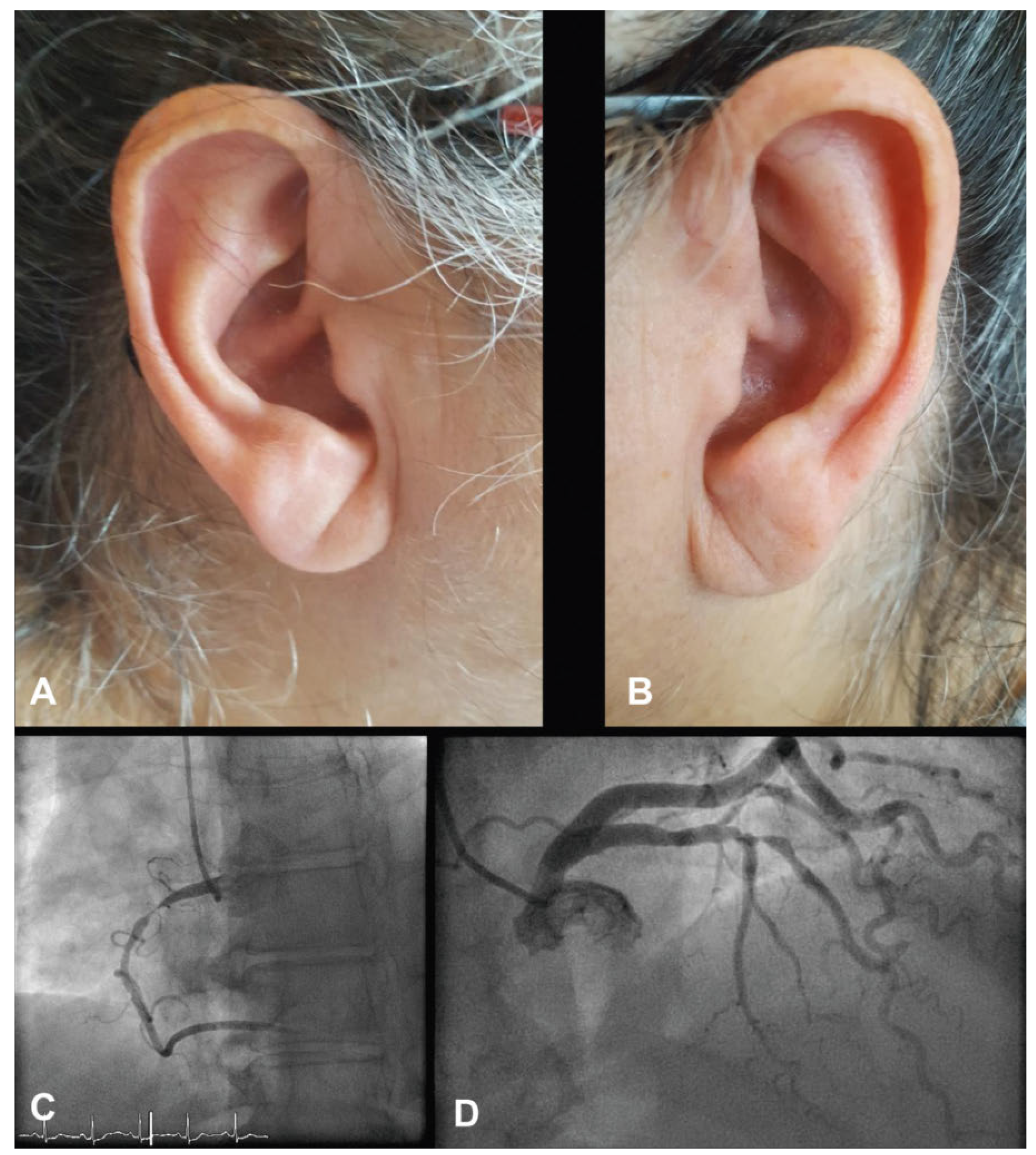 Cardiovascmed 20 00162 g001