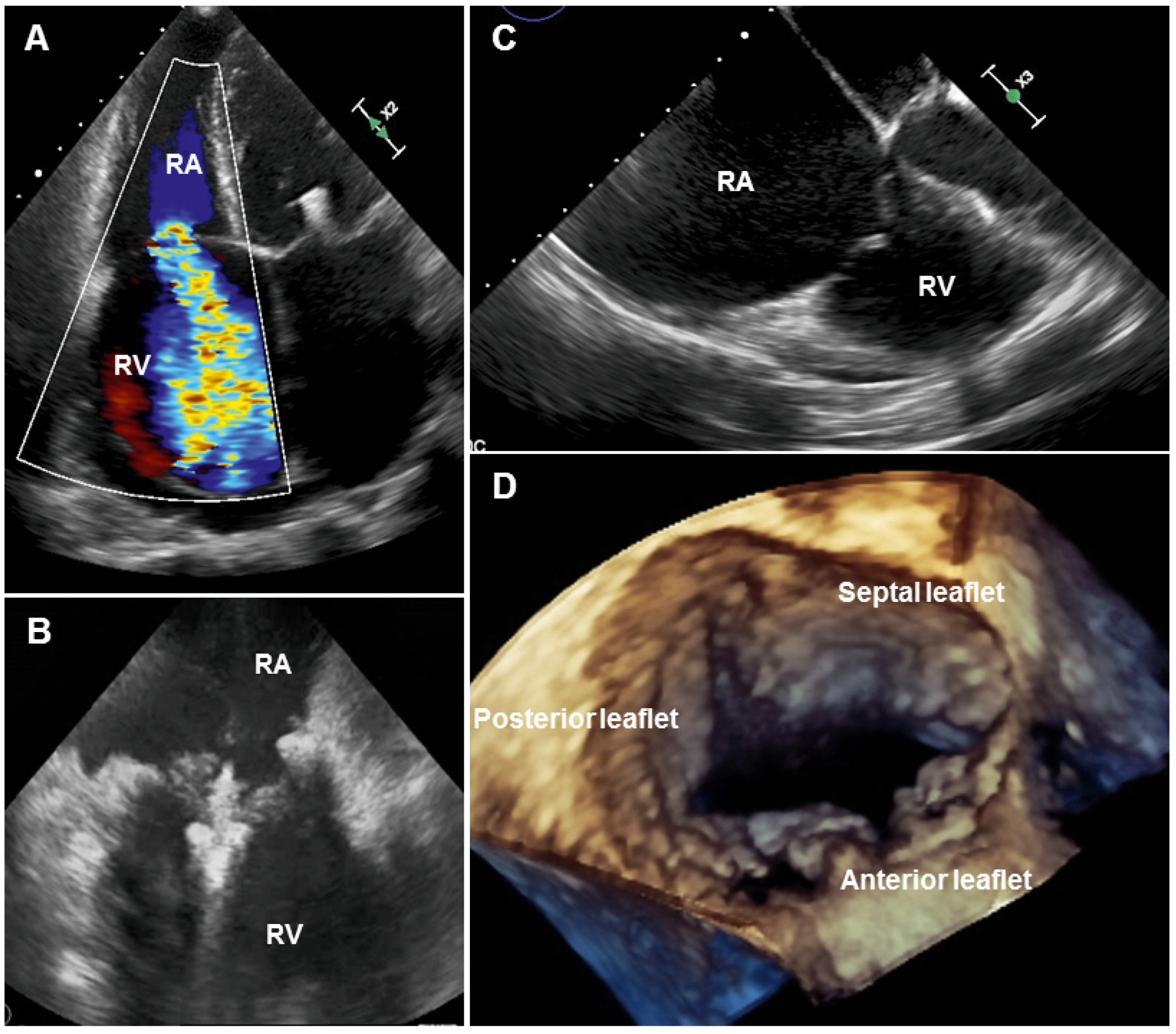 Cardiovascmed 20 00203 g001