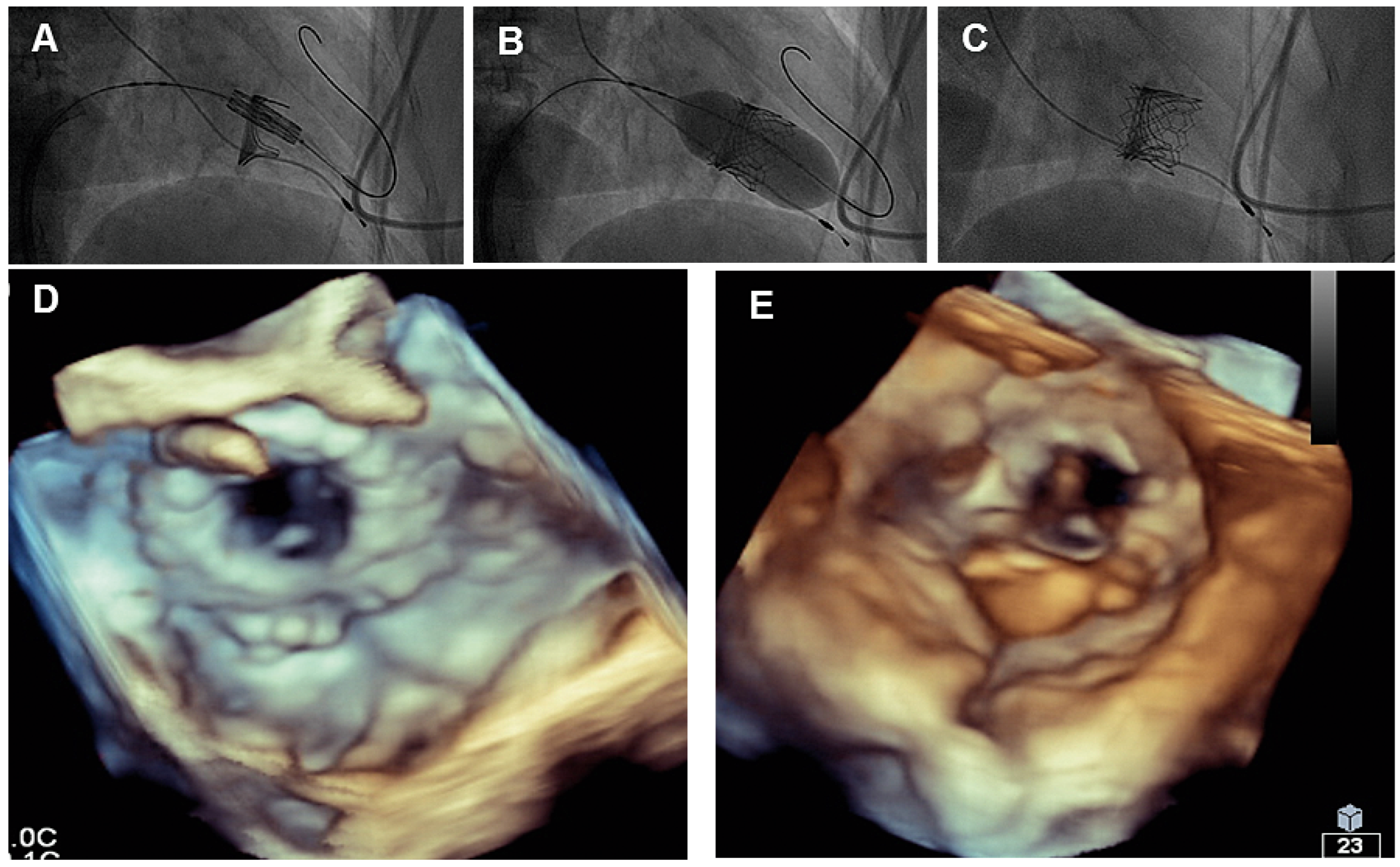 Cardiovascmed 20 00203 g002