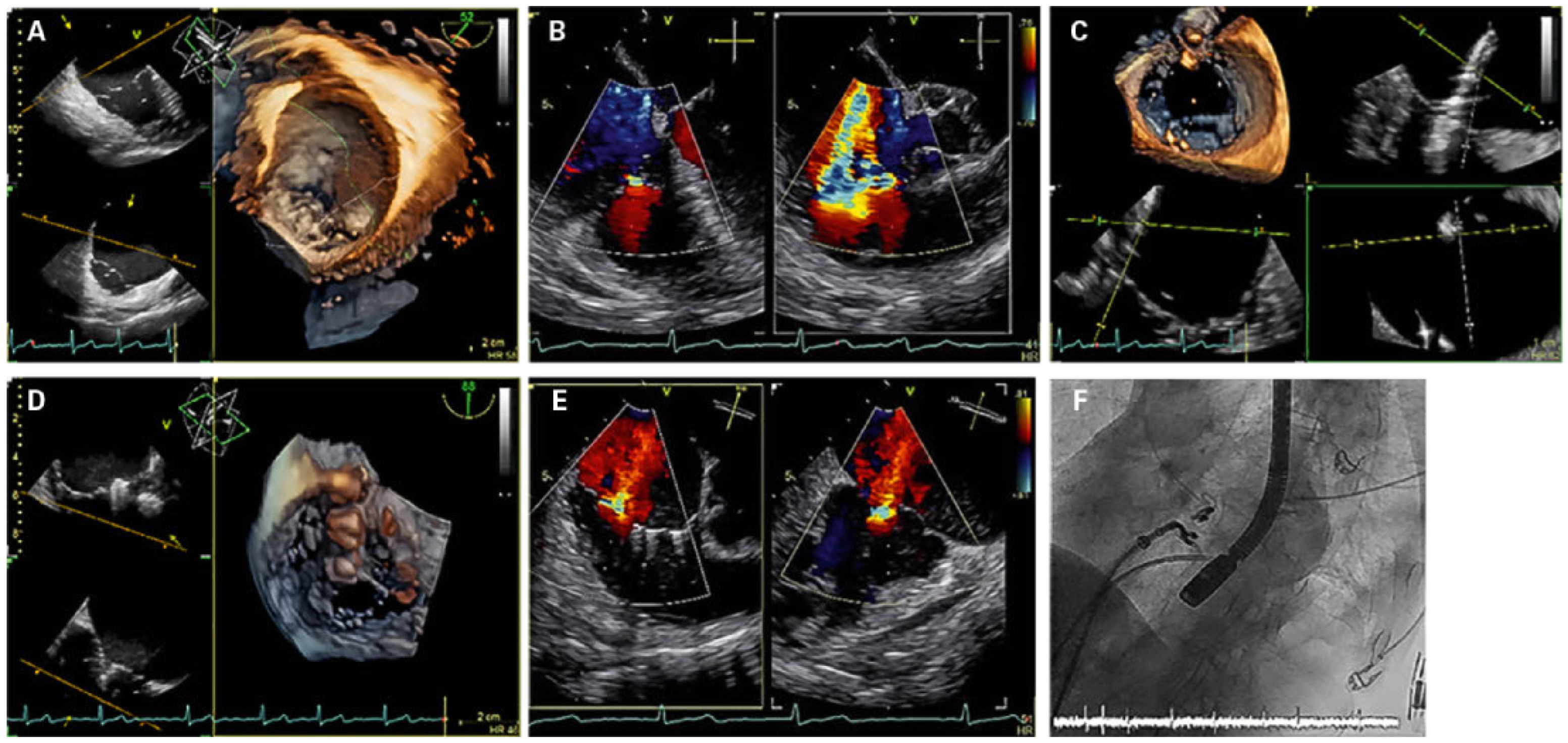 Cardiovascmed 20 00203 g004