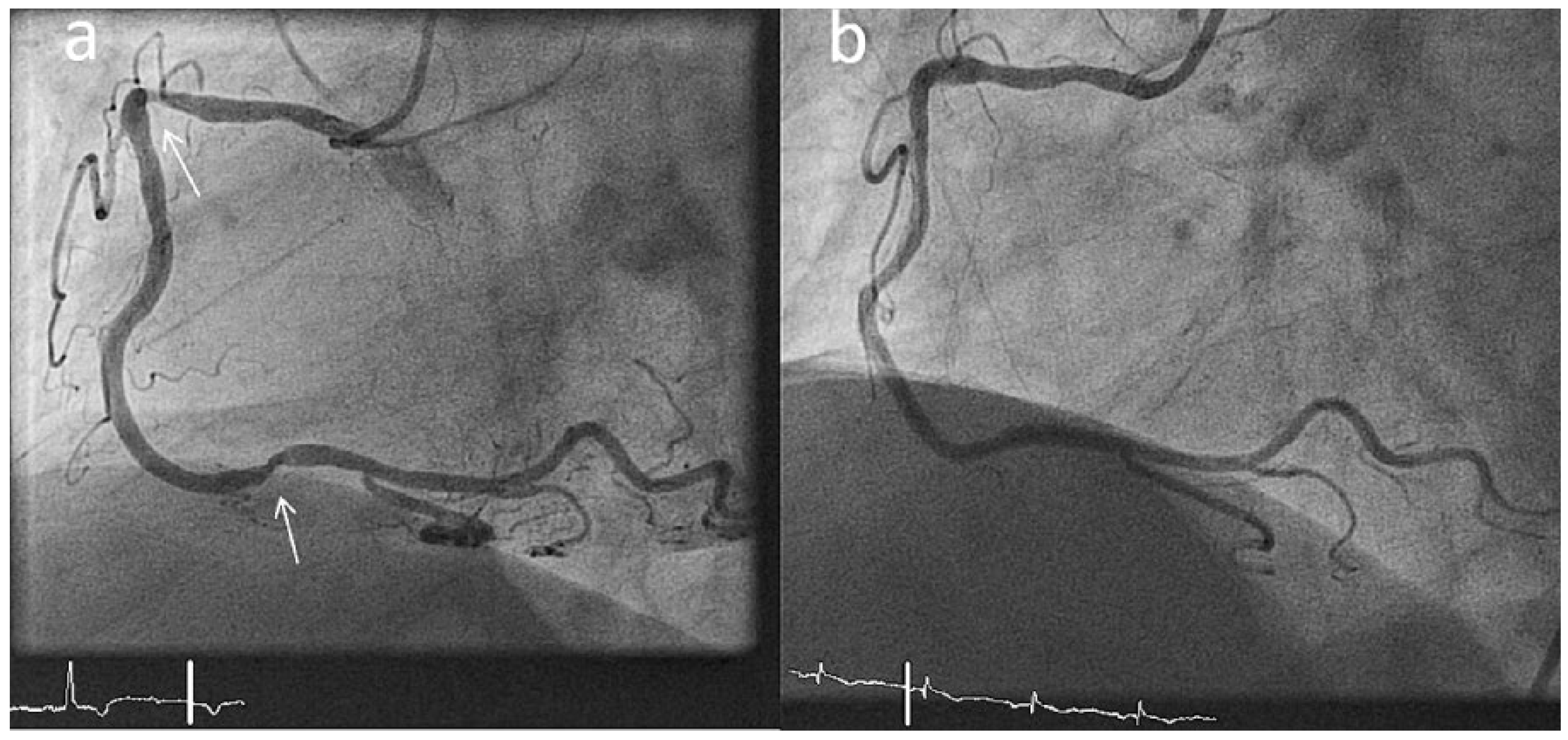 Cardiovascmed 20 00216 g001 Cardiovascmed 20 00216 g001