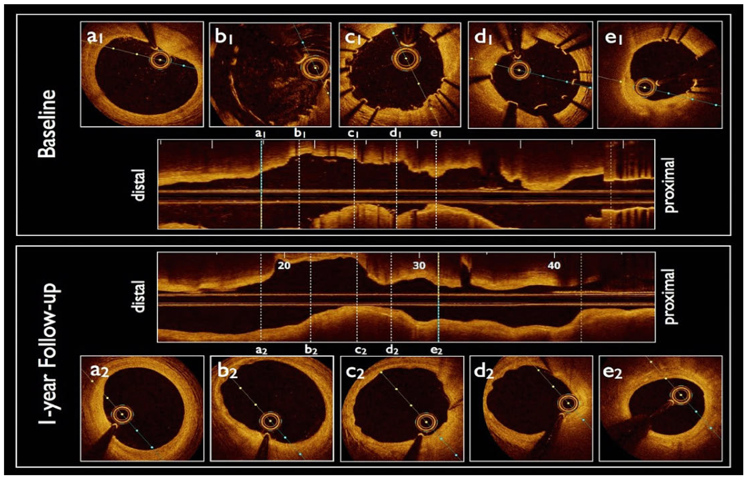 Cardiovascmed 20 00216 g002 Cardiovascmed 20 00216 g002