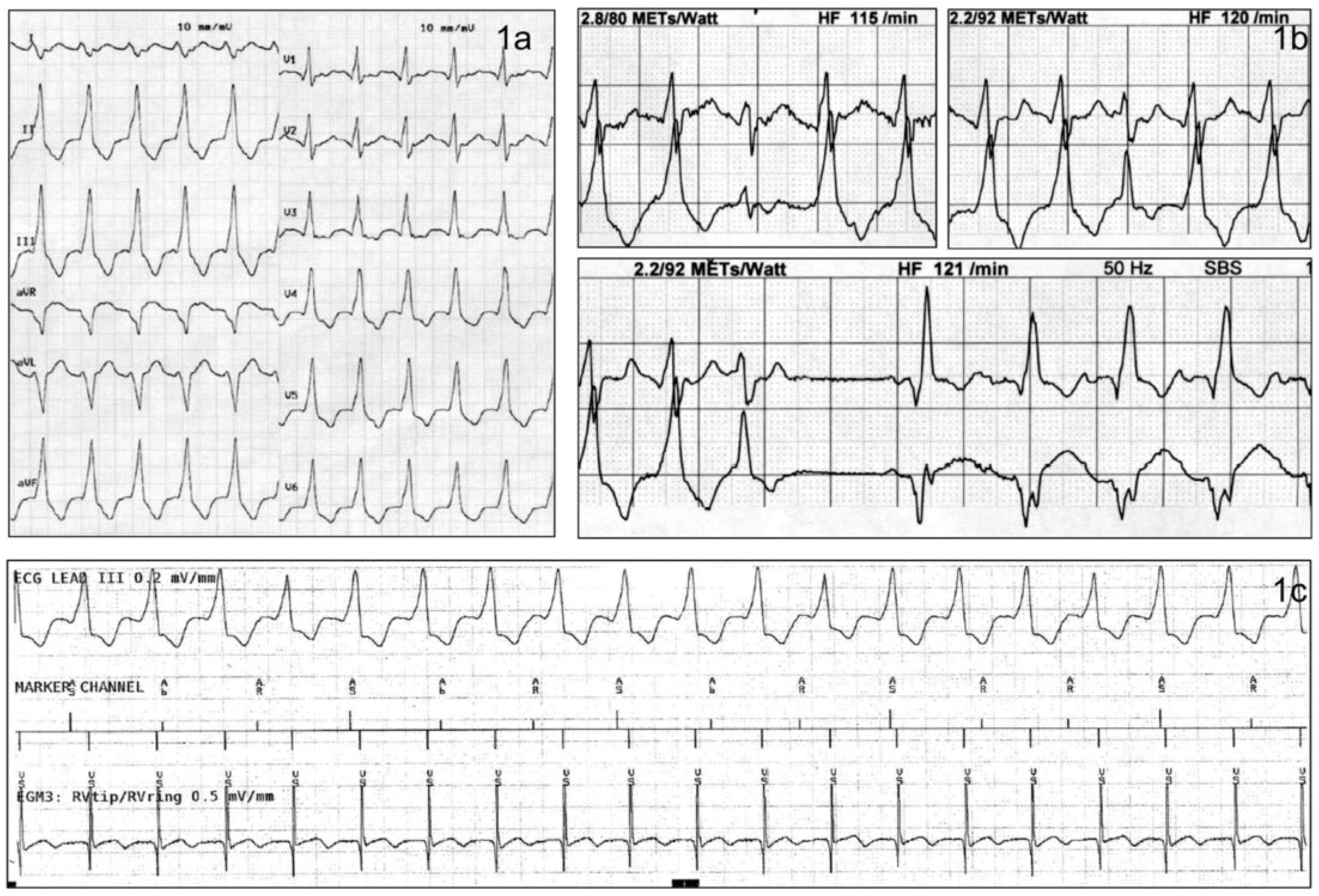 Cardiovascmed 20 00277 g001